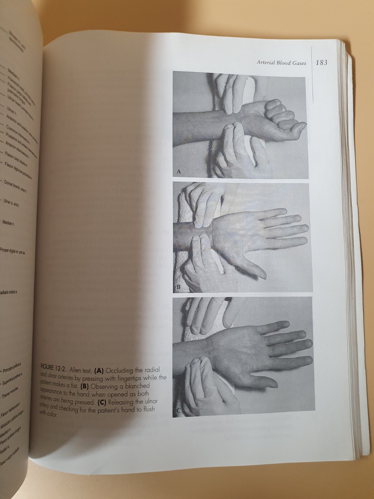Phlebotomy Exam Review/By Ruth E.McCall & Cathee M.Tankersley (1997)