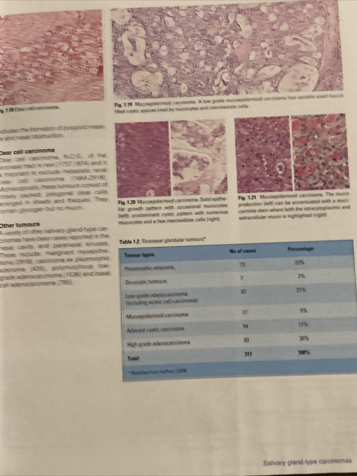 WHO Pathology and Genetics Head and Neck Tumours