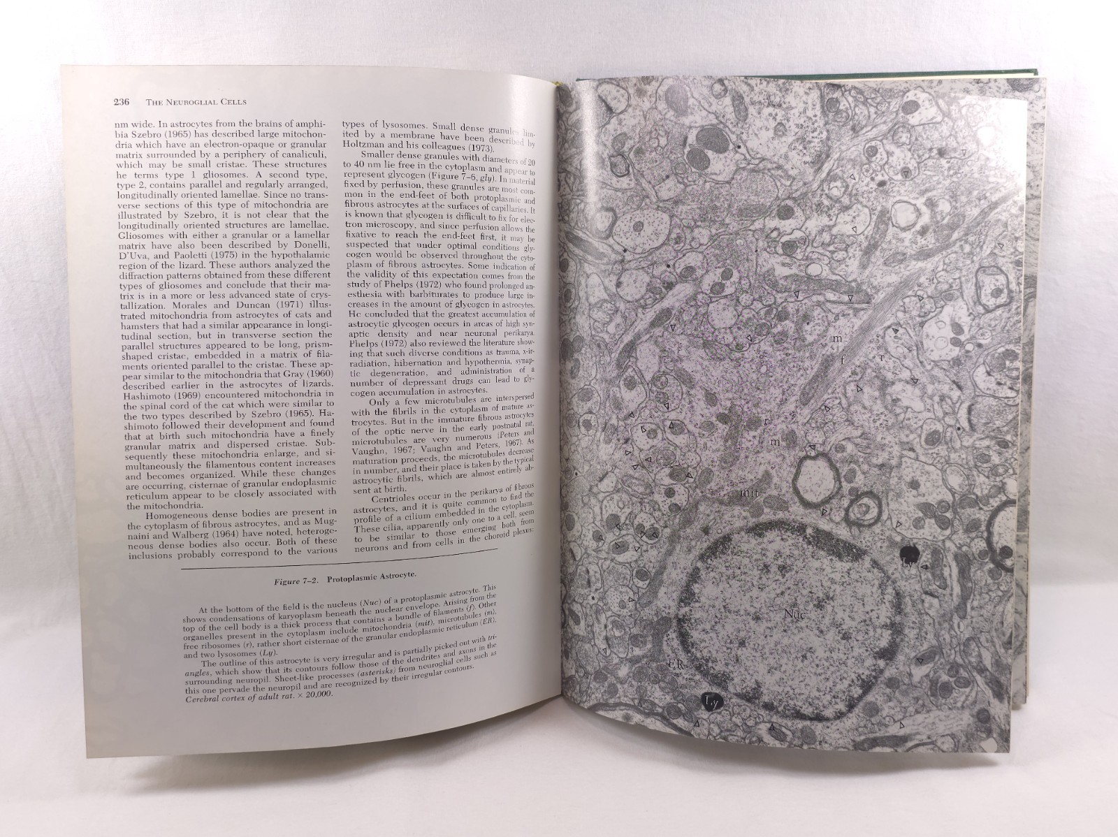 Fine Structure of the Nervous System Peters Palay Webster 1976