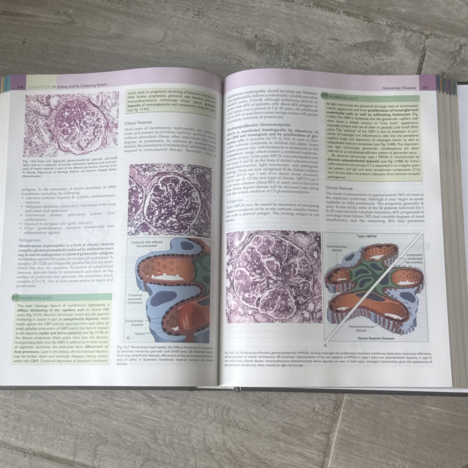 🌟 Robbins Basic Pathology Tenth Edition with Student Consult