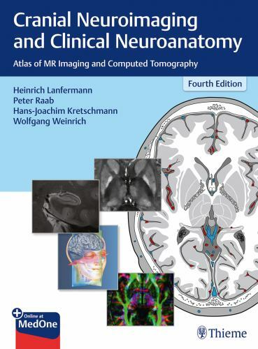 Cranial Neuroimaging and Clinical Neuroanatomy : Atlas of MR Imaging and Comp…