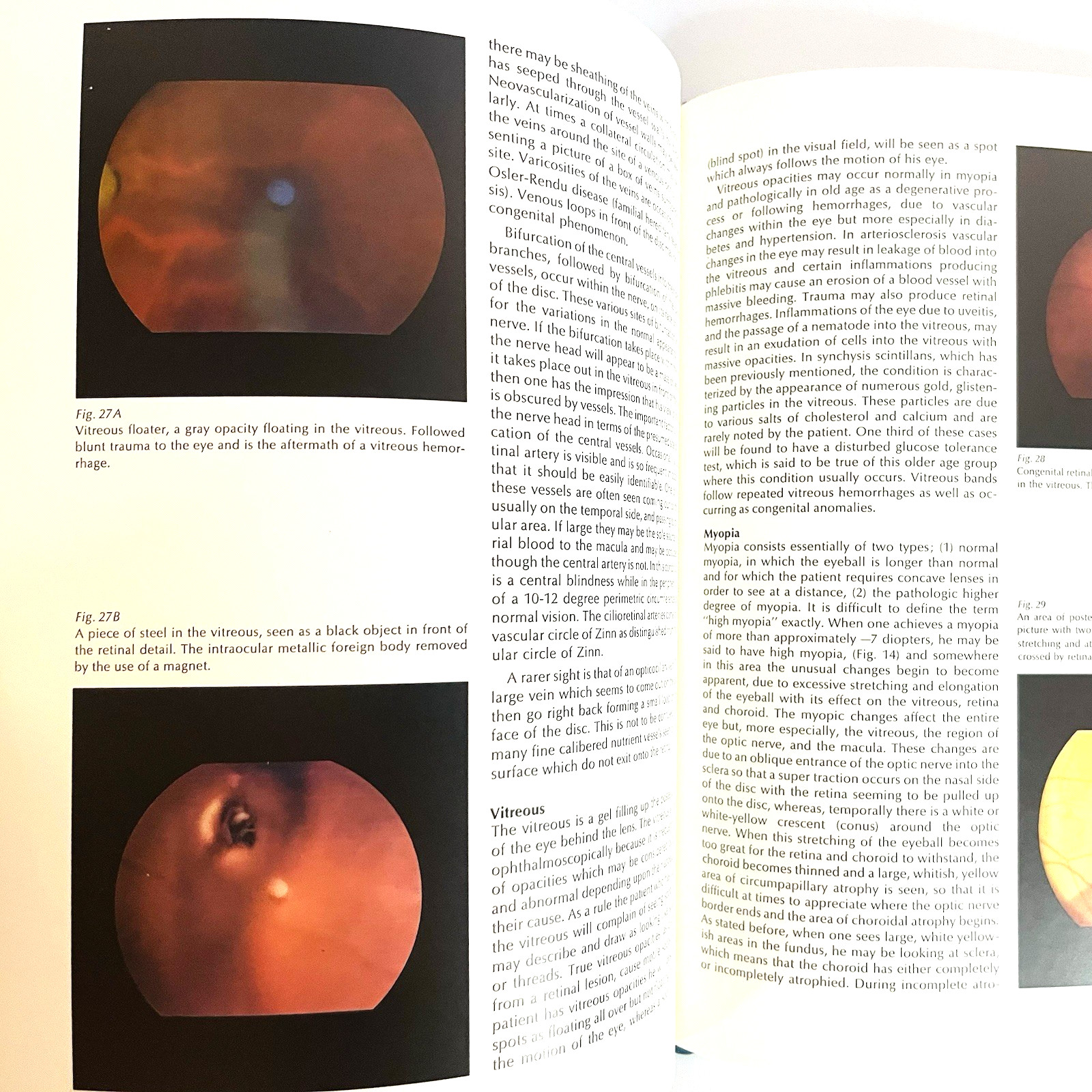 Vintage Monograph on the Fundamentals of Ophthalmoscopy Book Hardcover 1971