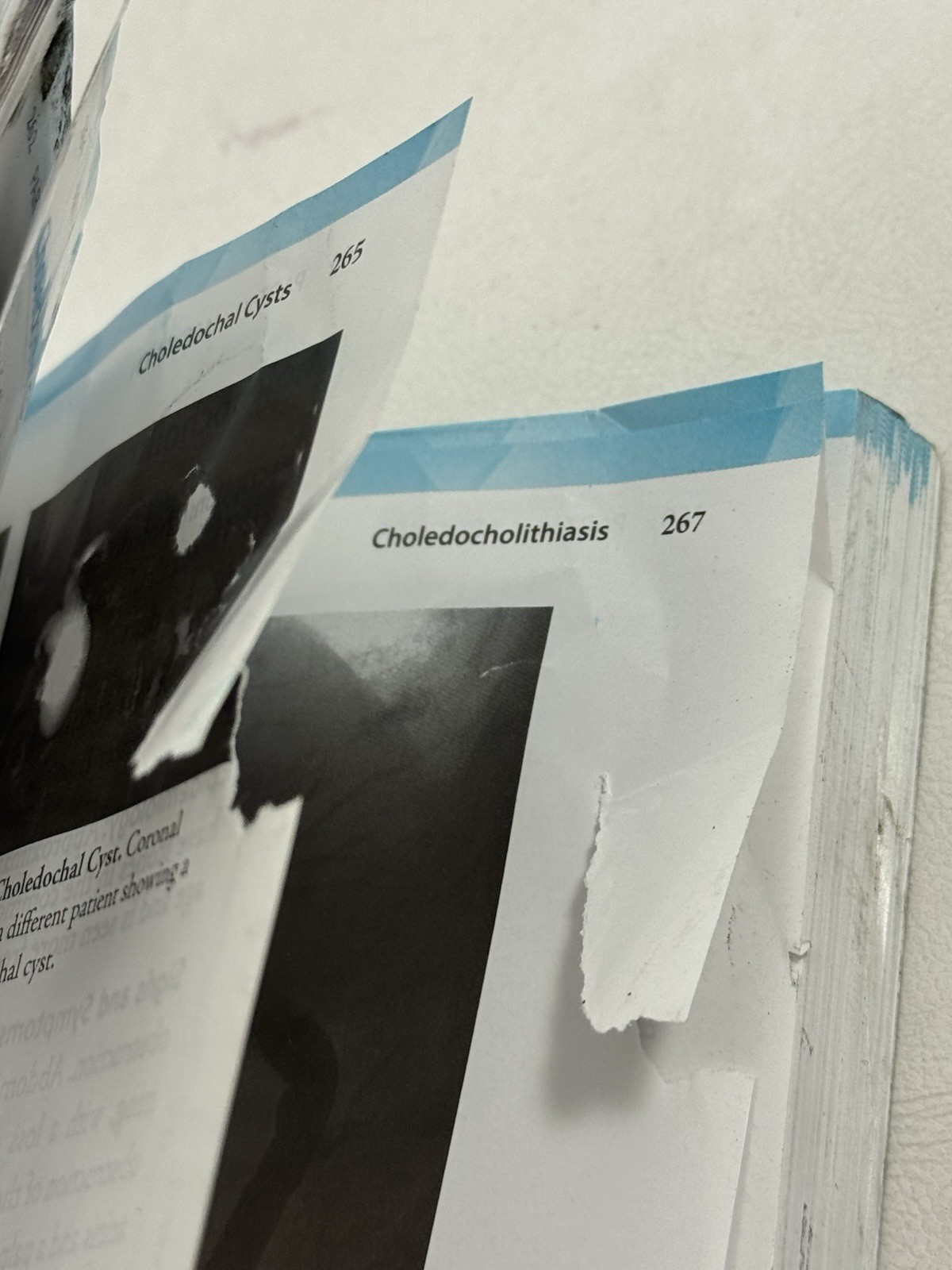 CT & MRI Pathology: A Pocket Atlas, Third Edition – Paperback, by GREY