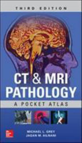 CT & MRI Pathology: A Pocket Atlas, Third Edition by GREY