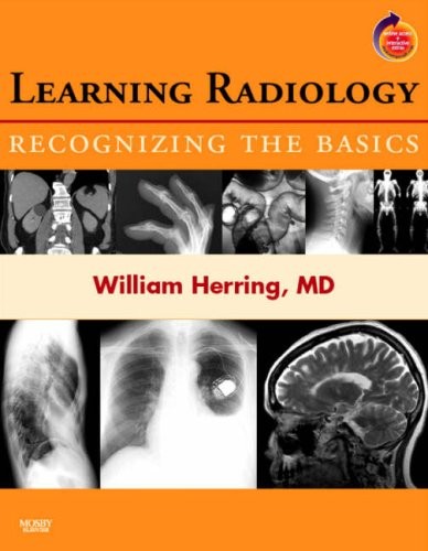 Learning Radiology: Recognizing the Basics (With STUDENT CONSULT Online Acce…