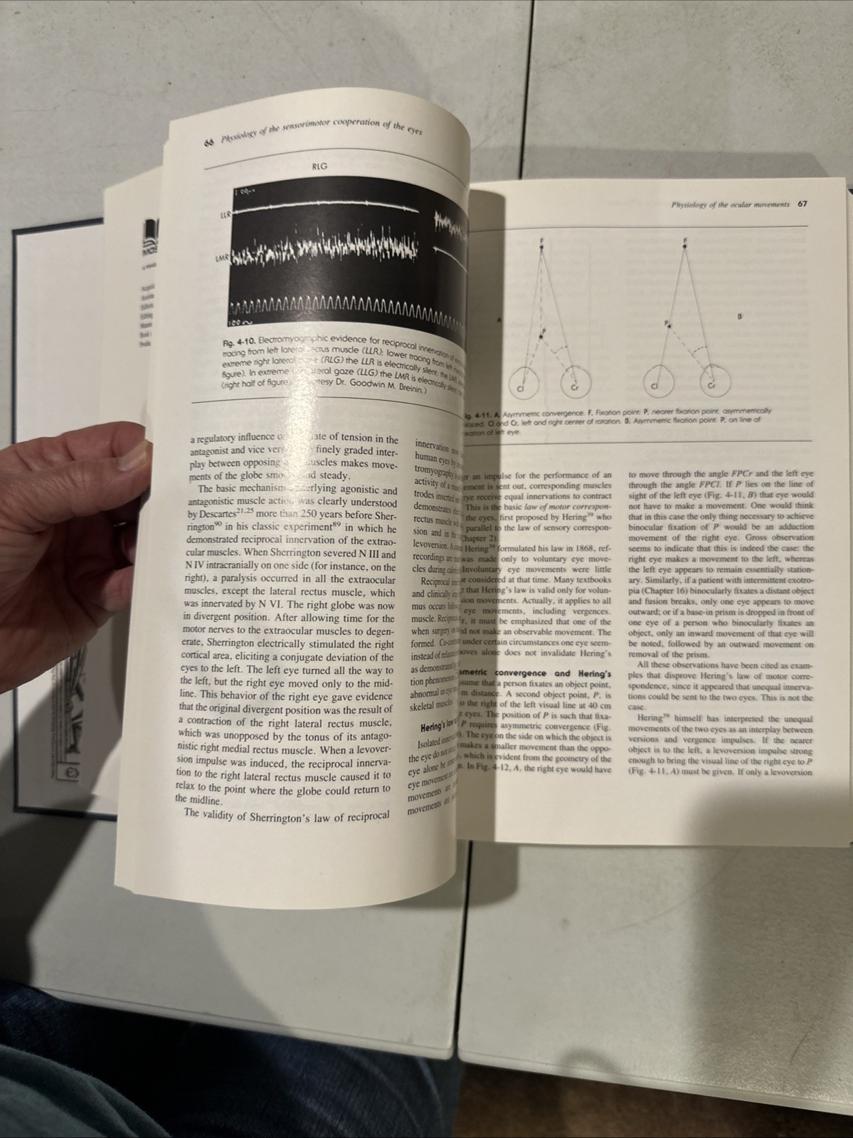 Binocular Vision And Ocular Motility. Von Noorden. 1985. Ophthalmology