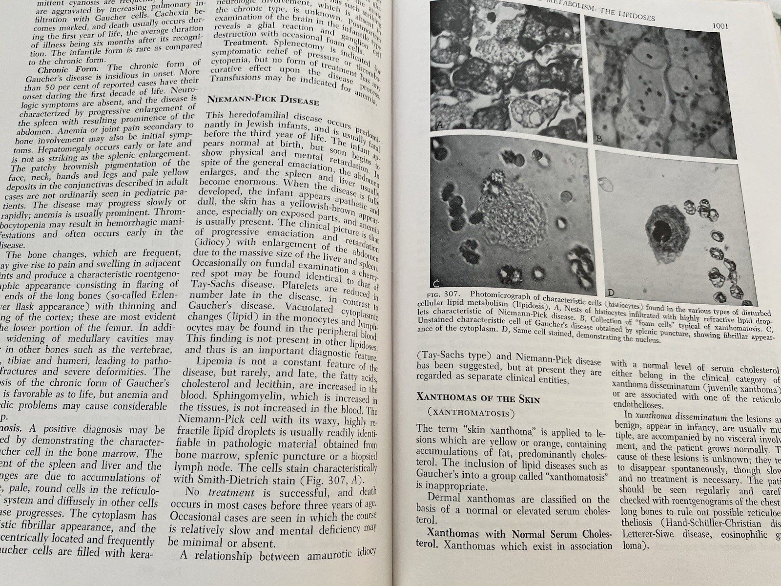 Vintage Medical Book: Textbook of Pediatrics Waldo Nelson W B Saunders 1959