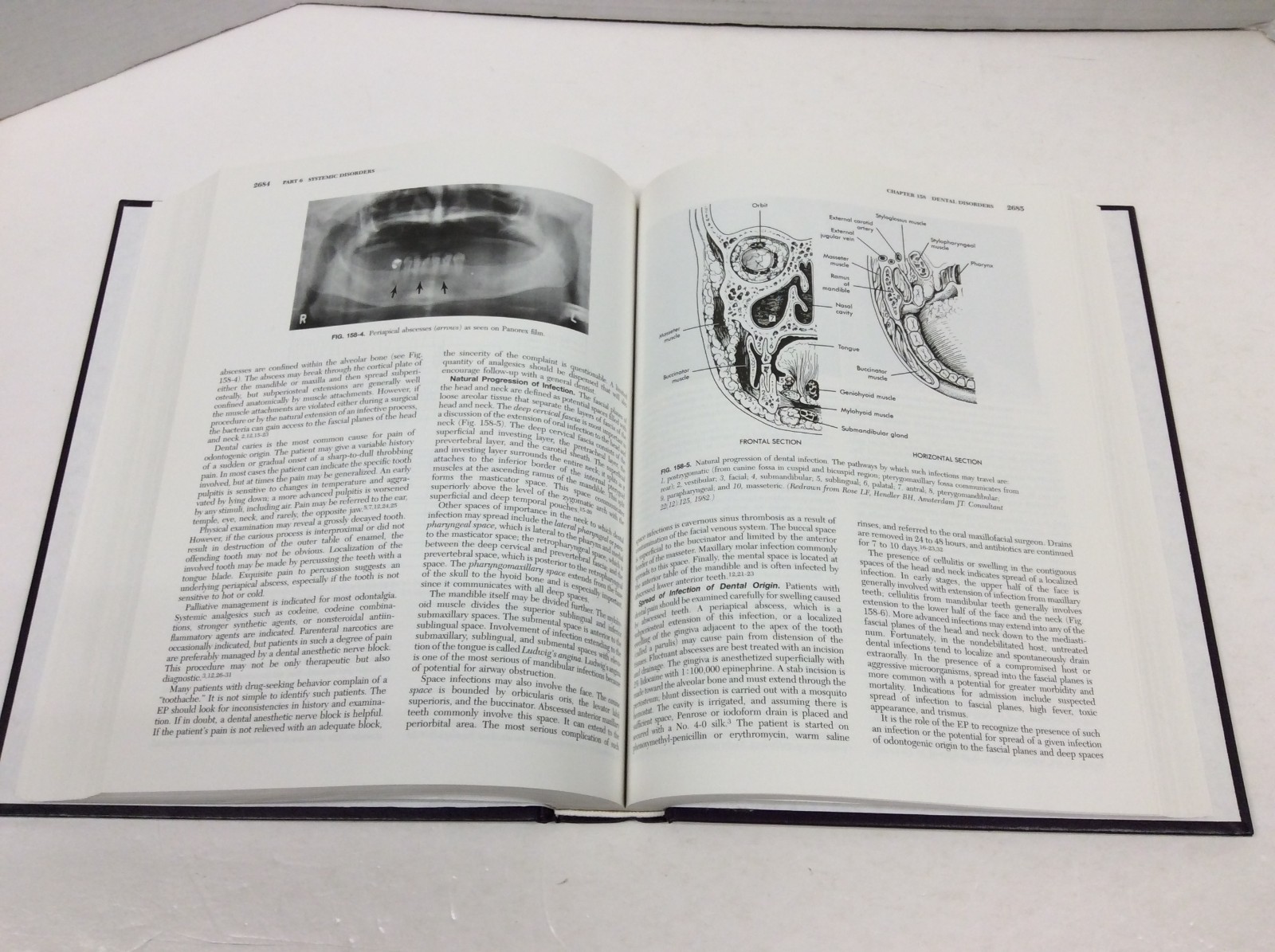 EMERGENCY MEDICINE: CONCEPTS & CLINICAL PRACTICE VOL 1-3 Rosen & Barkin HC 1998