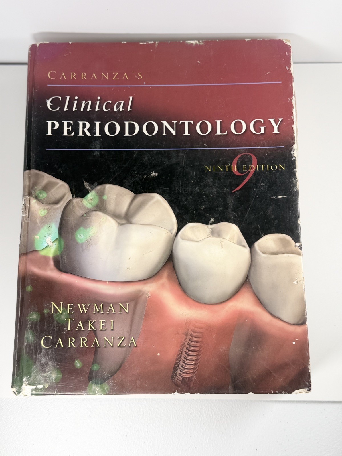 Carranza’s Clinical Periodontology 9th Edition