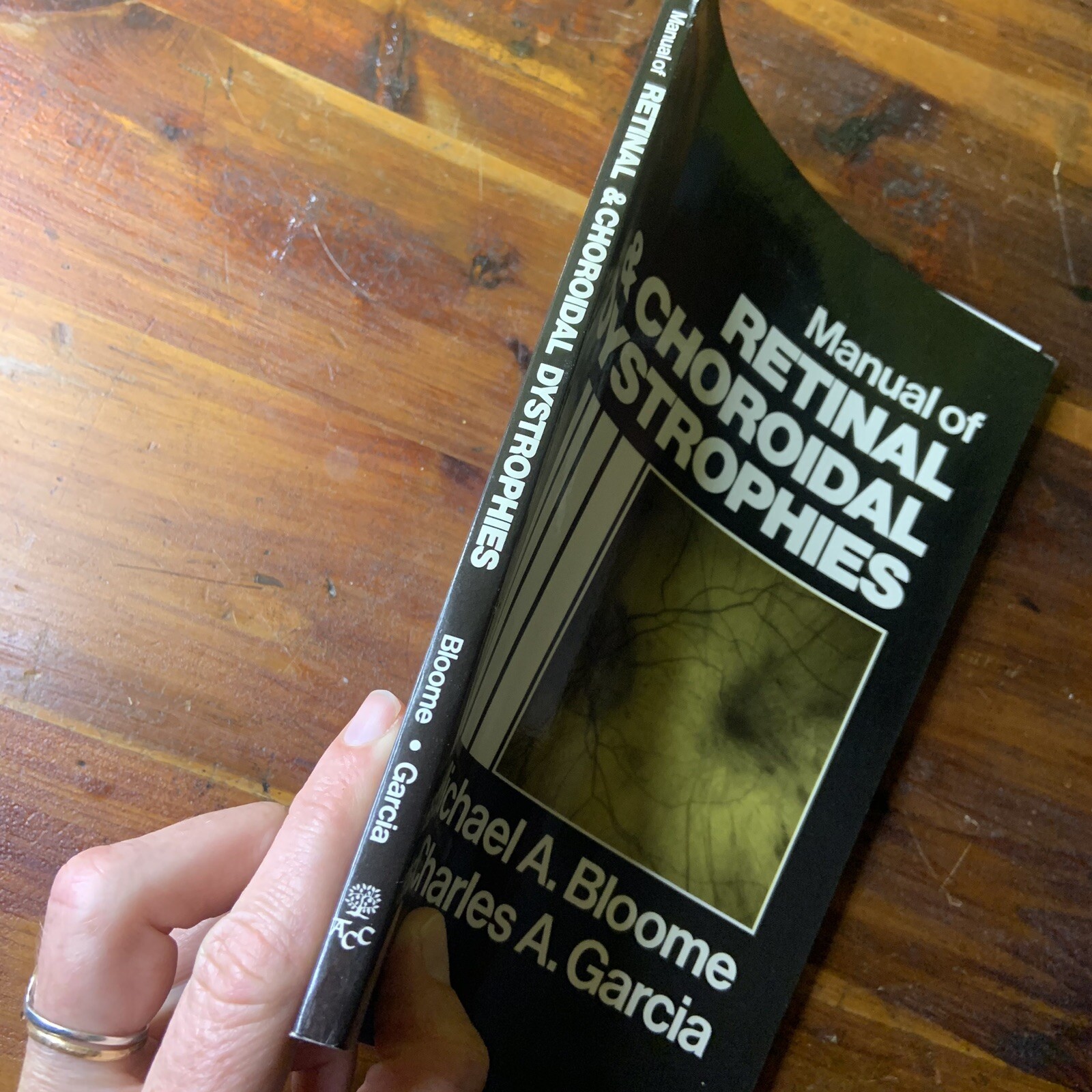 Manual of Retinal and Choroidal Dystrophies Michael Bloom Charles Garcia 1982