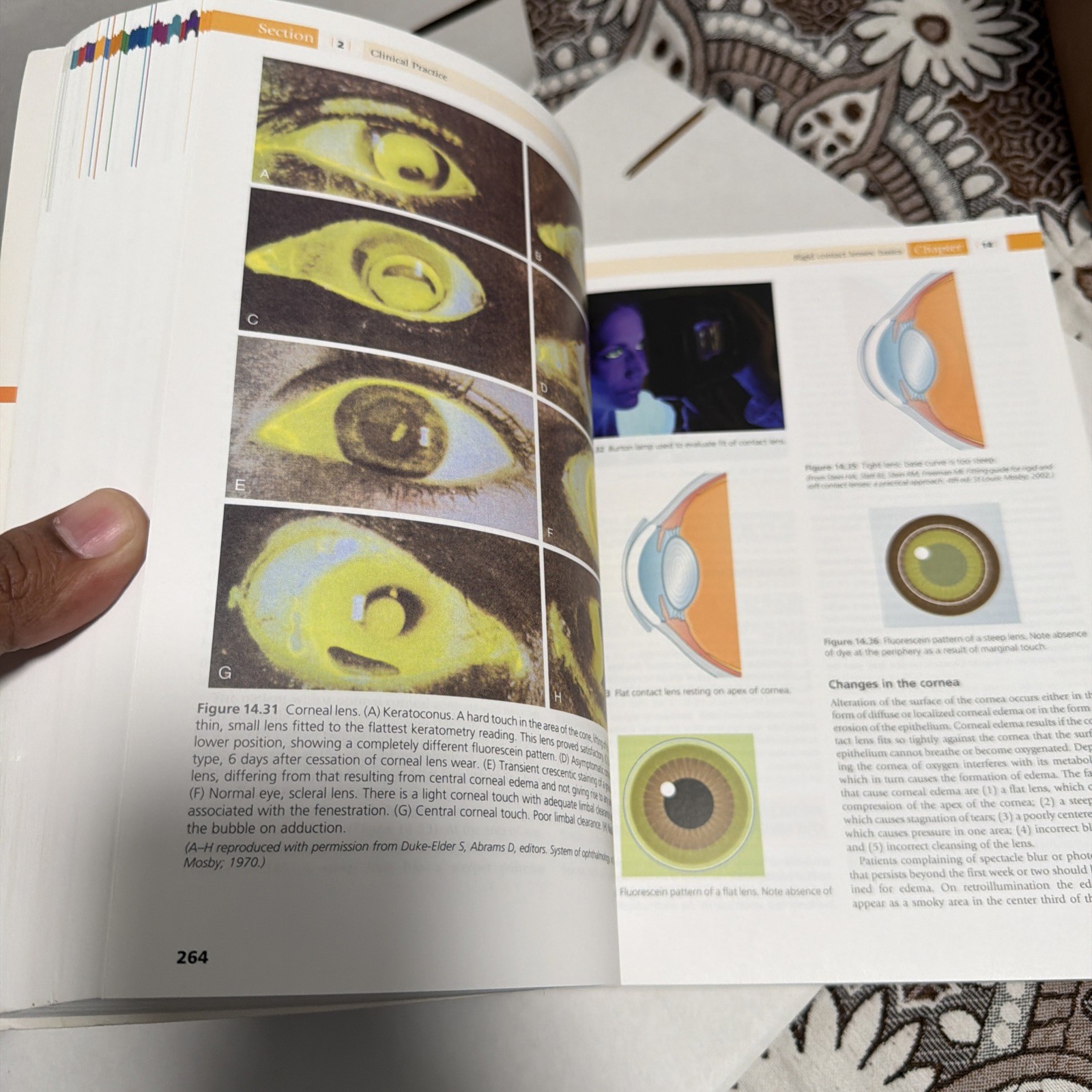 The Ophthalmic Assistant : A Text for Allied and Associated Ophth
