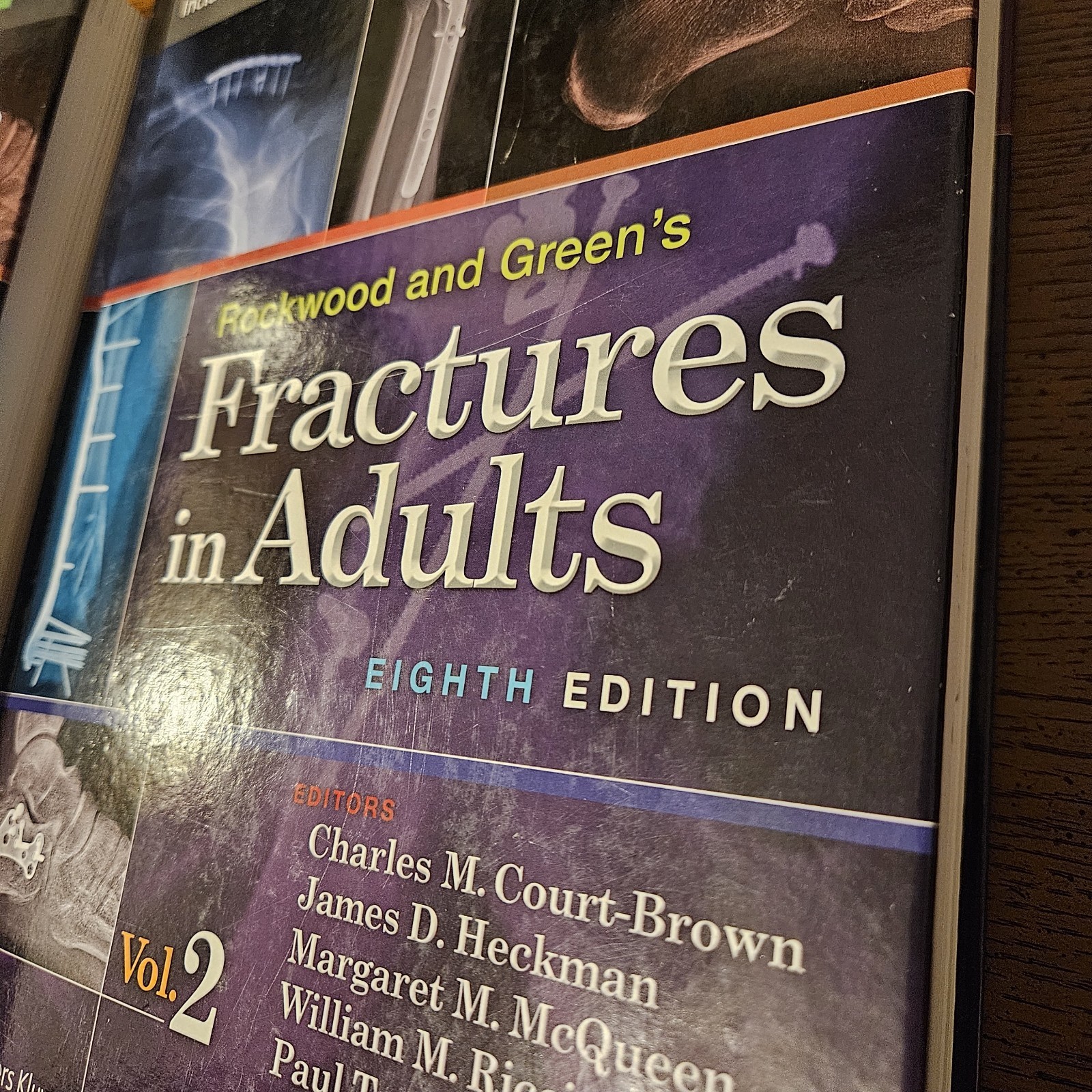 Rockwood and Green’s Fractures In Adults, Eighth Edition, Volumes 1 & 2