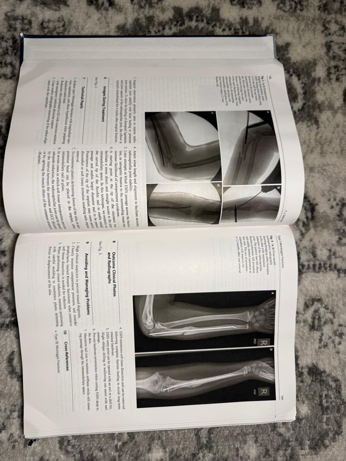 Pediatric Orthopedic Trauma Case Atlas Hardcover Medical Book Springer