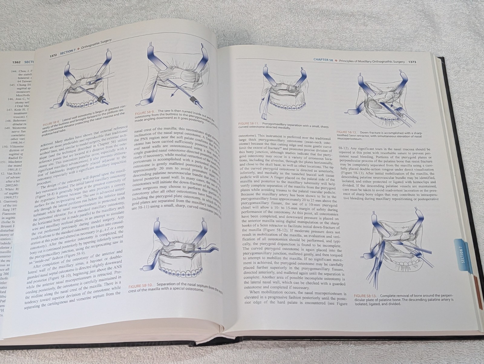 Volume 2 Only Peterson’s Principles of Oral and Maxillofacial Surgery Ghali USED