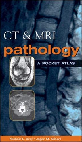 CT & MRI Pathology: A Pocket Atlas – paperback Michael L. Grey|Jagan M. Aili…