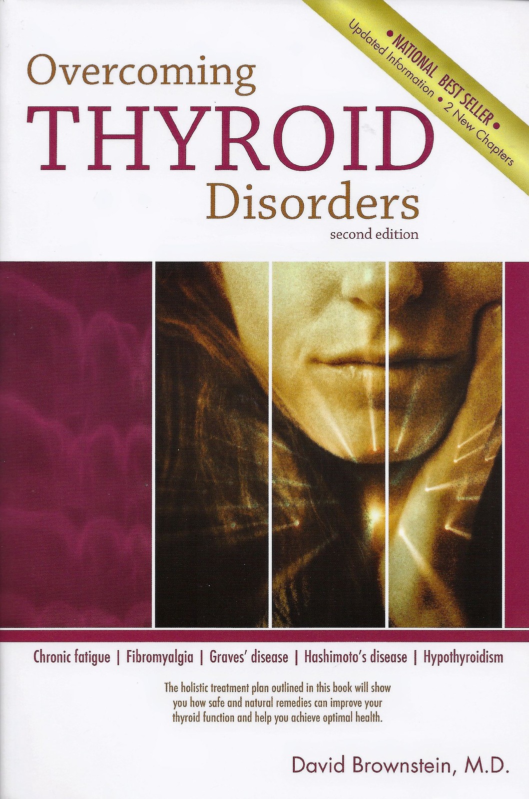 Overcoming Thyroid Disorders by Brownstein, David (2002) Paperback – Brownst…