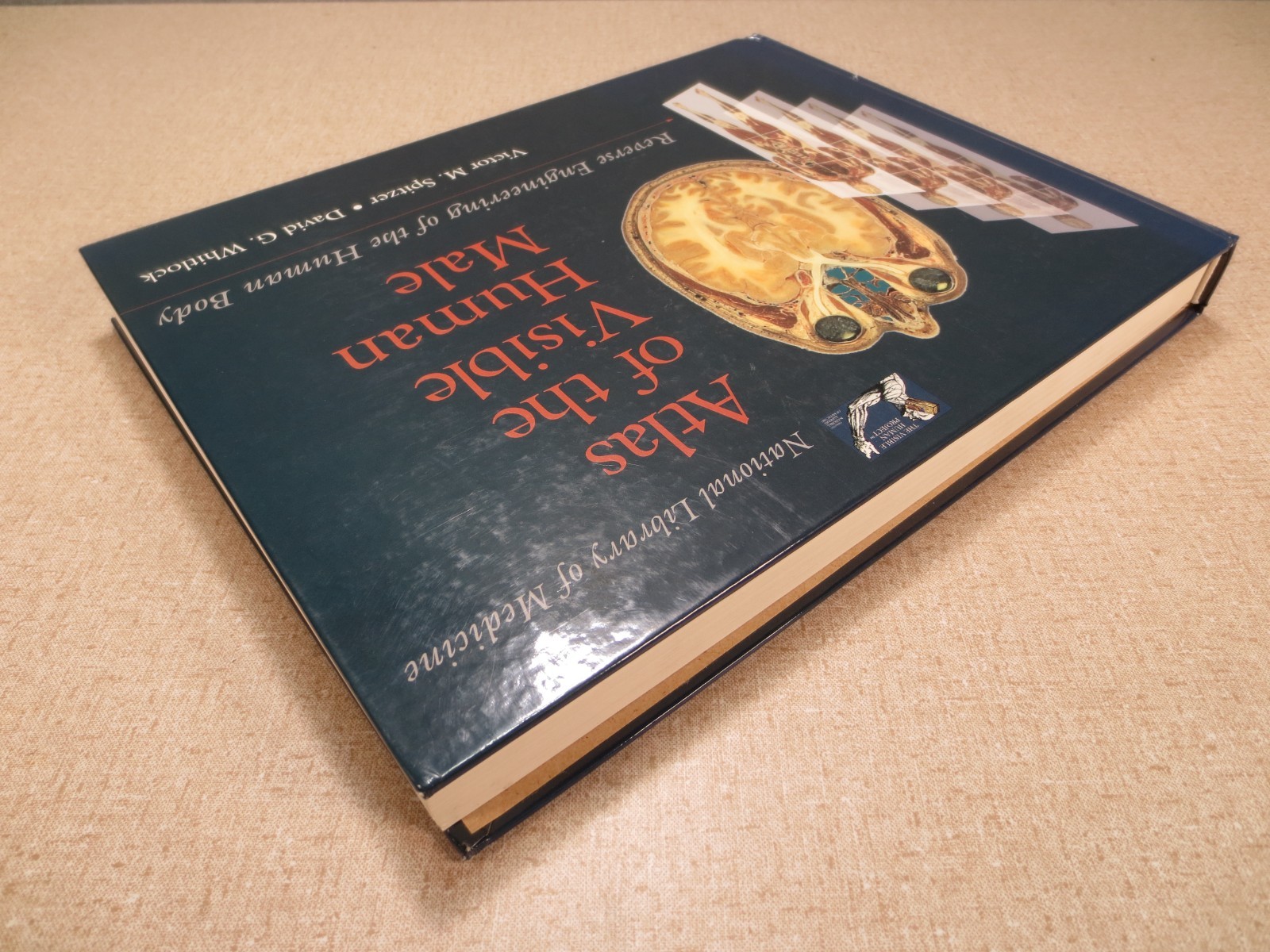 National Library of Medicine Atlas of The Visible Human Male Victor Spitzer