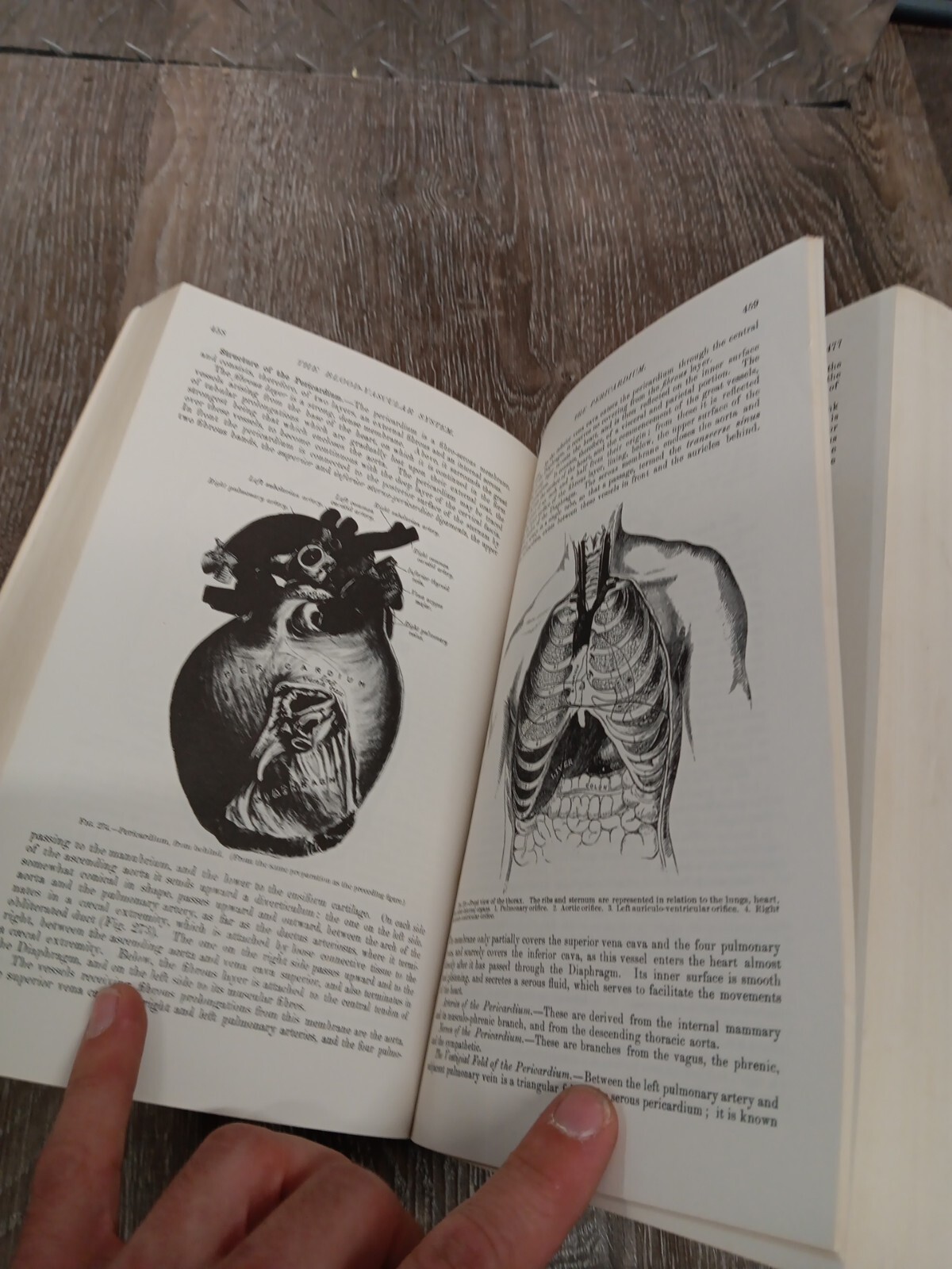 Gray’s Anatomy The ILLUSTRATED Running Press Edition Of The American Classic ’74