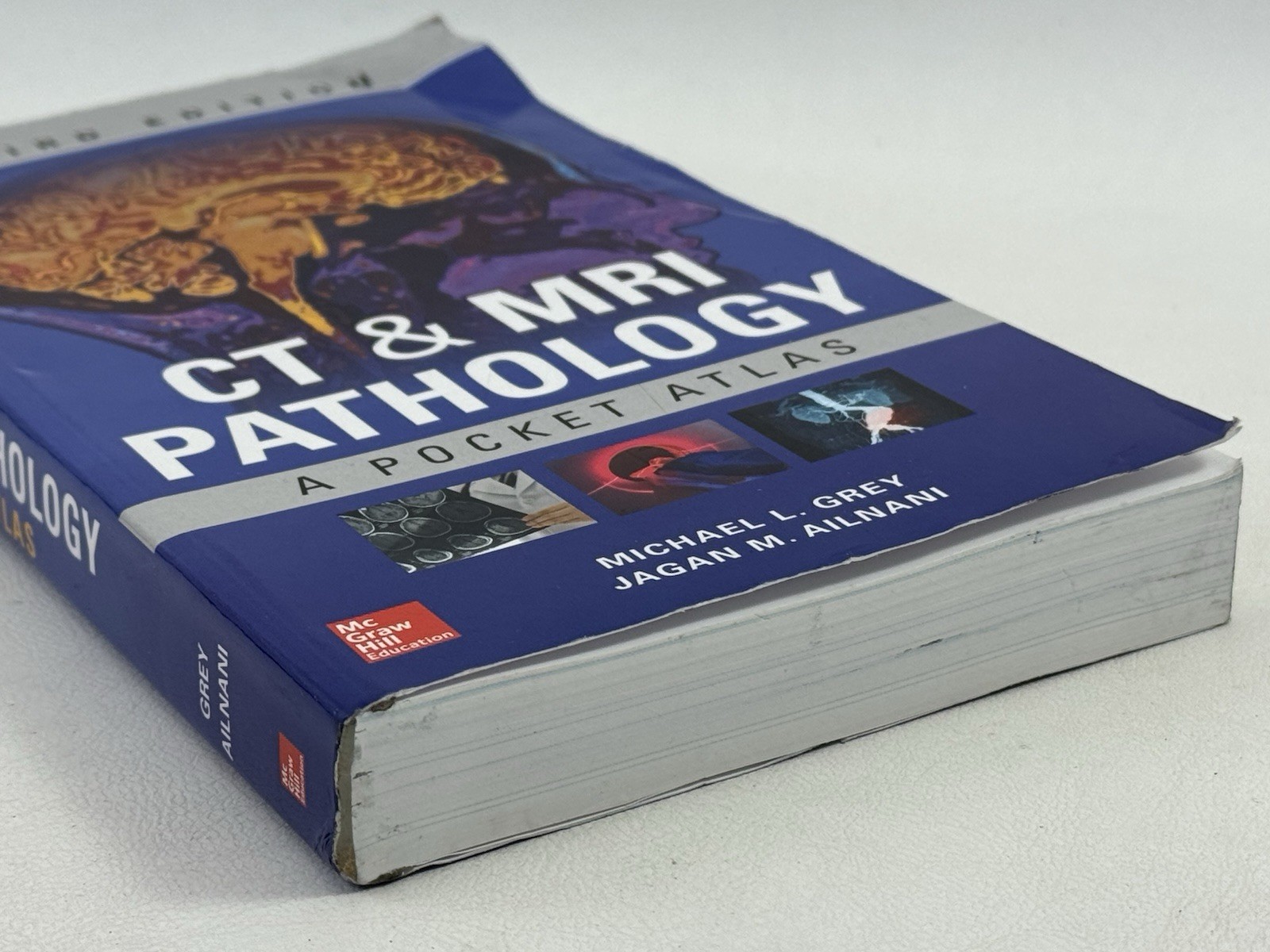 CT & MRI Pathology: A Pocket Atlas, Third Edition – Paperback, by GREY