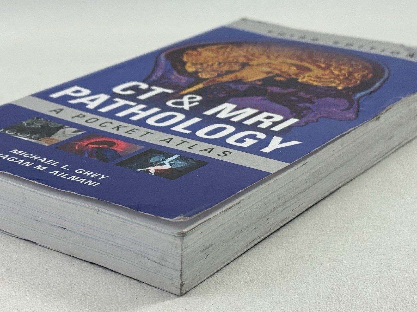 CT & MRI Pathology: A Pocket Atlas, Third Edition – Paperback, by GREY