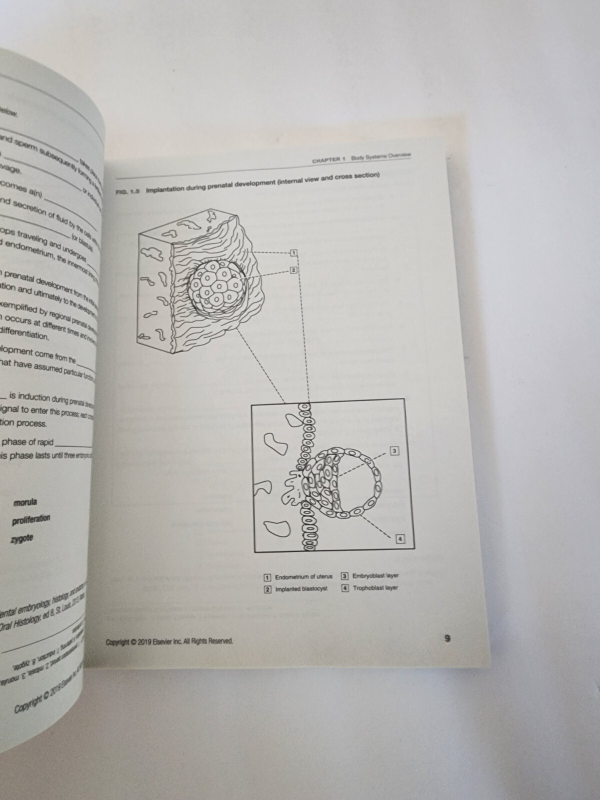 Dental Anatomy Coloring Book, Paperback by Fehrenbach, Margaret J. (EDT), Bra…