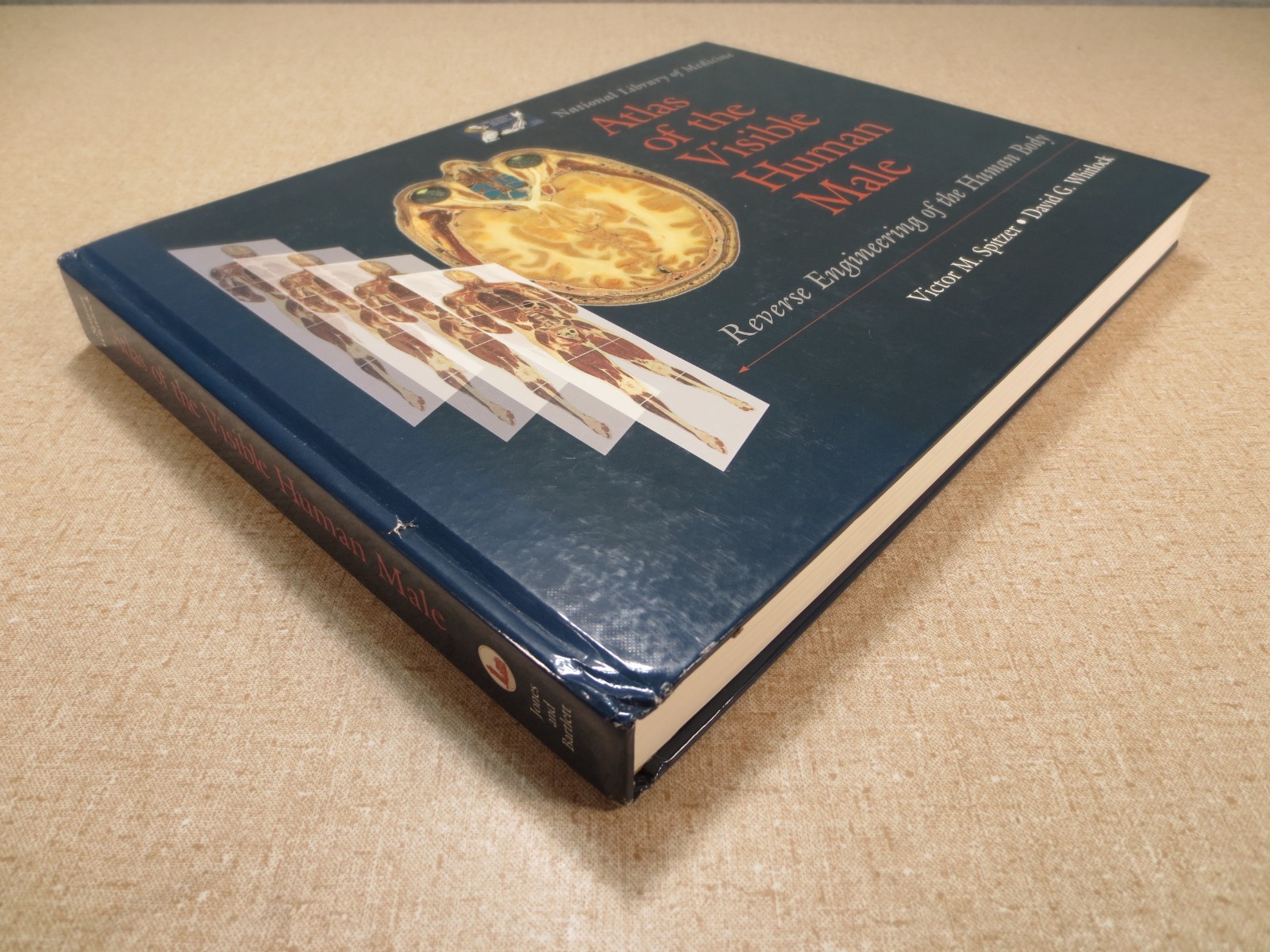 National Library of Medicine Atlas of The Visible Human Male Victor Spitzer
