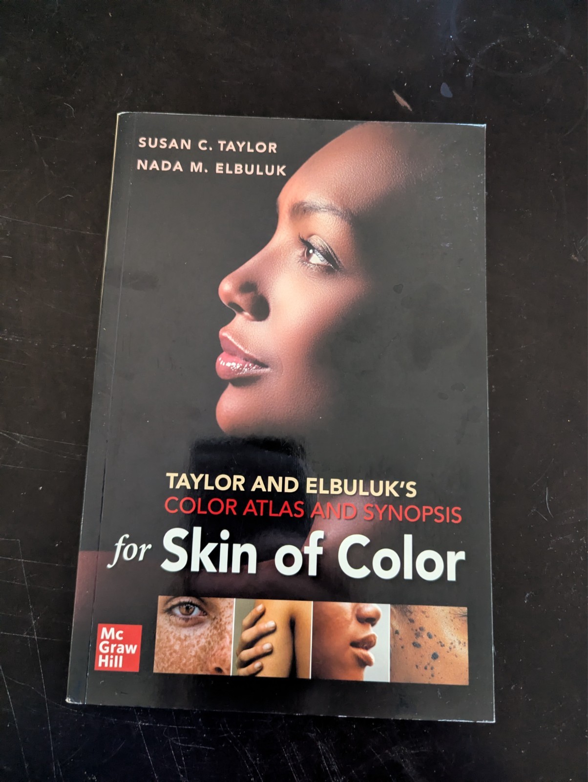 Taylor and Elbuluk’s Color Atlas and Synopsis for Skin of Color