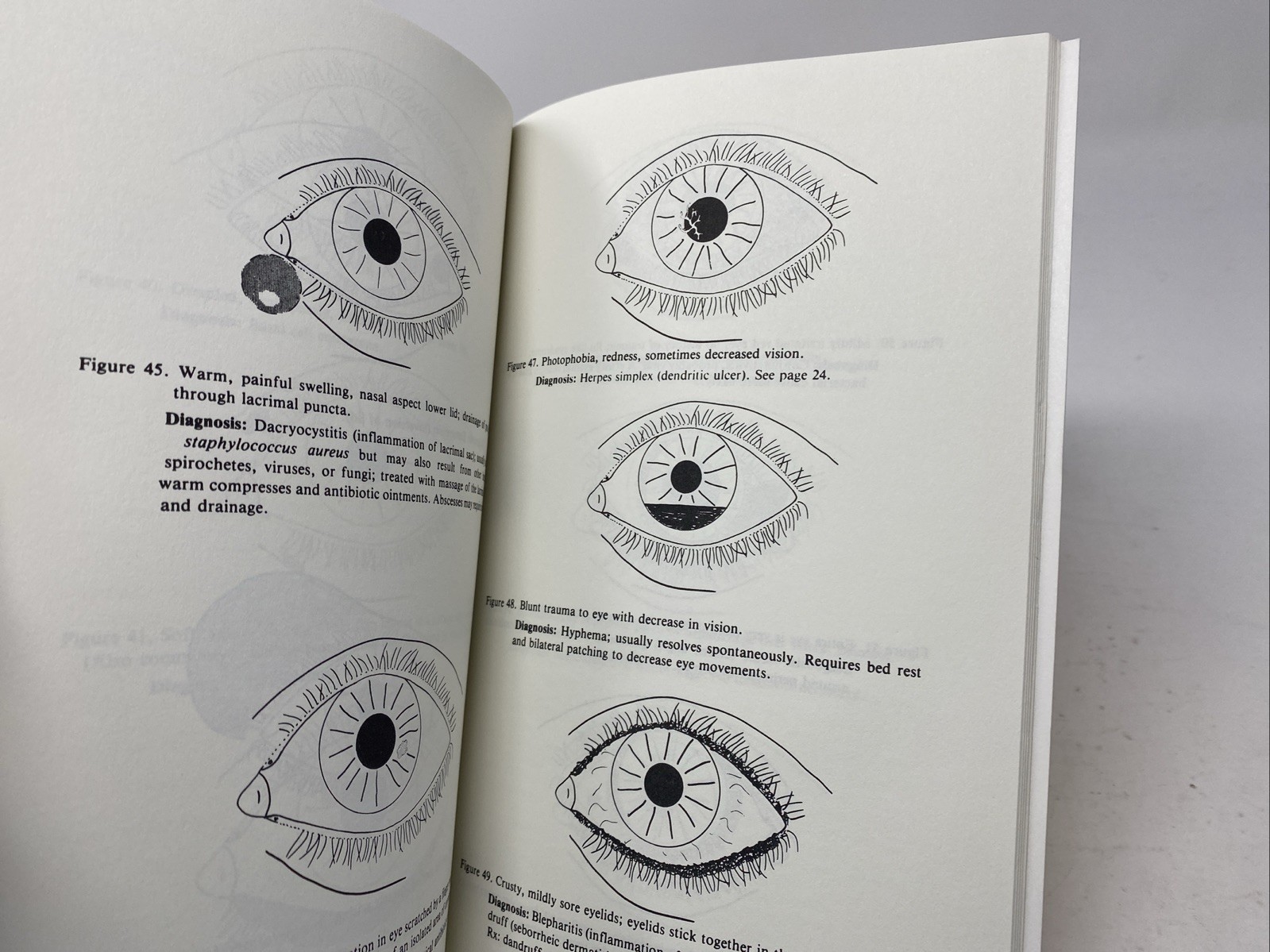 Ophthalmology Made Ridiculously Simple, Interactive CD (Atlas) + 3rd Ed.~Book