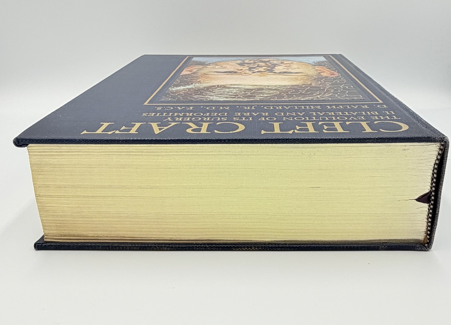 Cleft Craft Vol 2 Evolution Of Its Surgery The Unilateral Deformity Millard 1977
