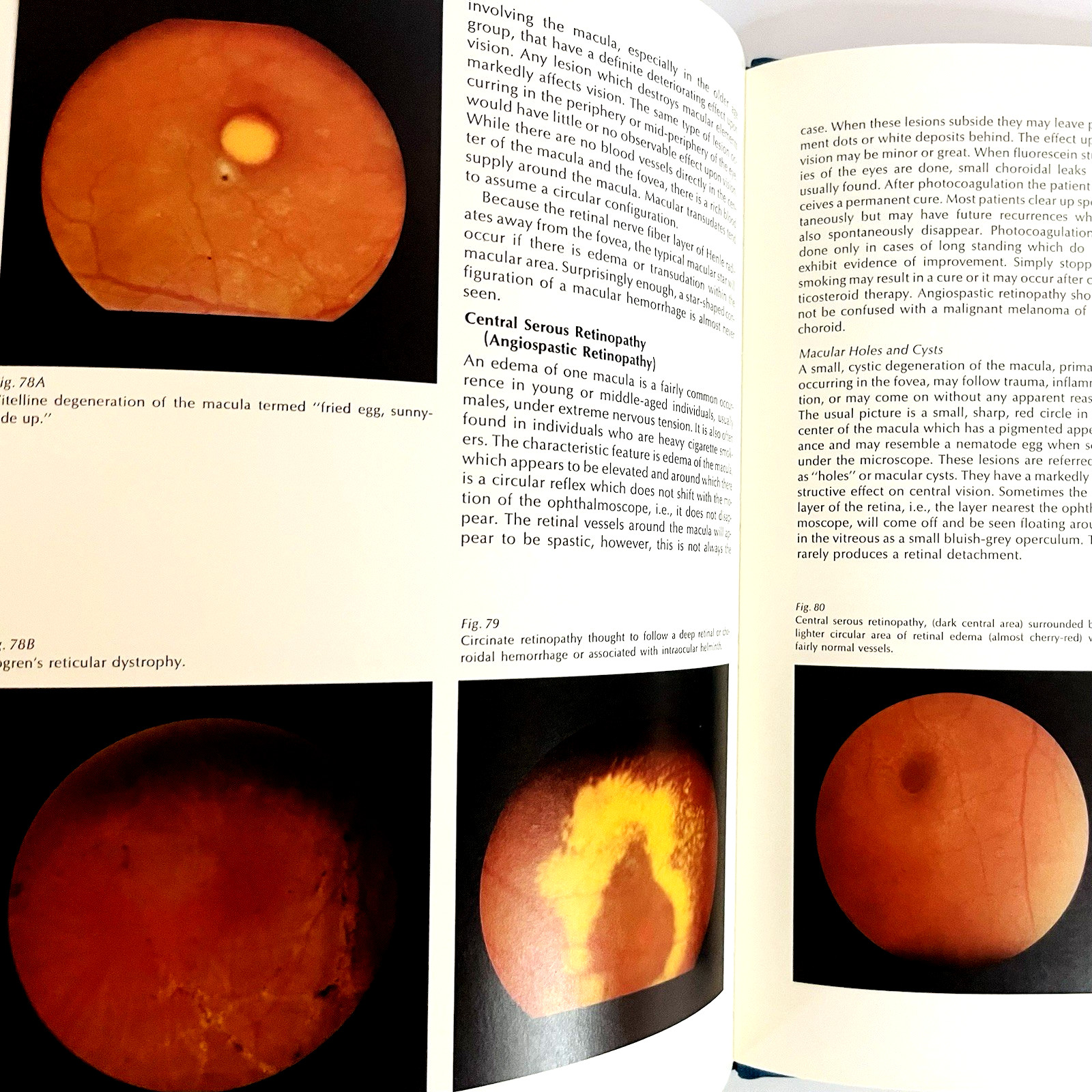 Vintage Monograph on the Fundamentals of Ophthalmoscopy Book Hardcover 1971