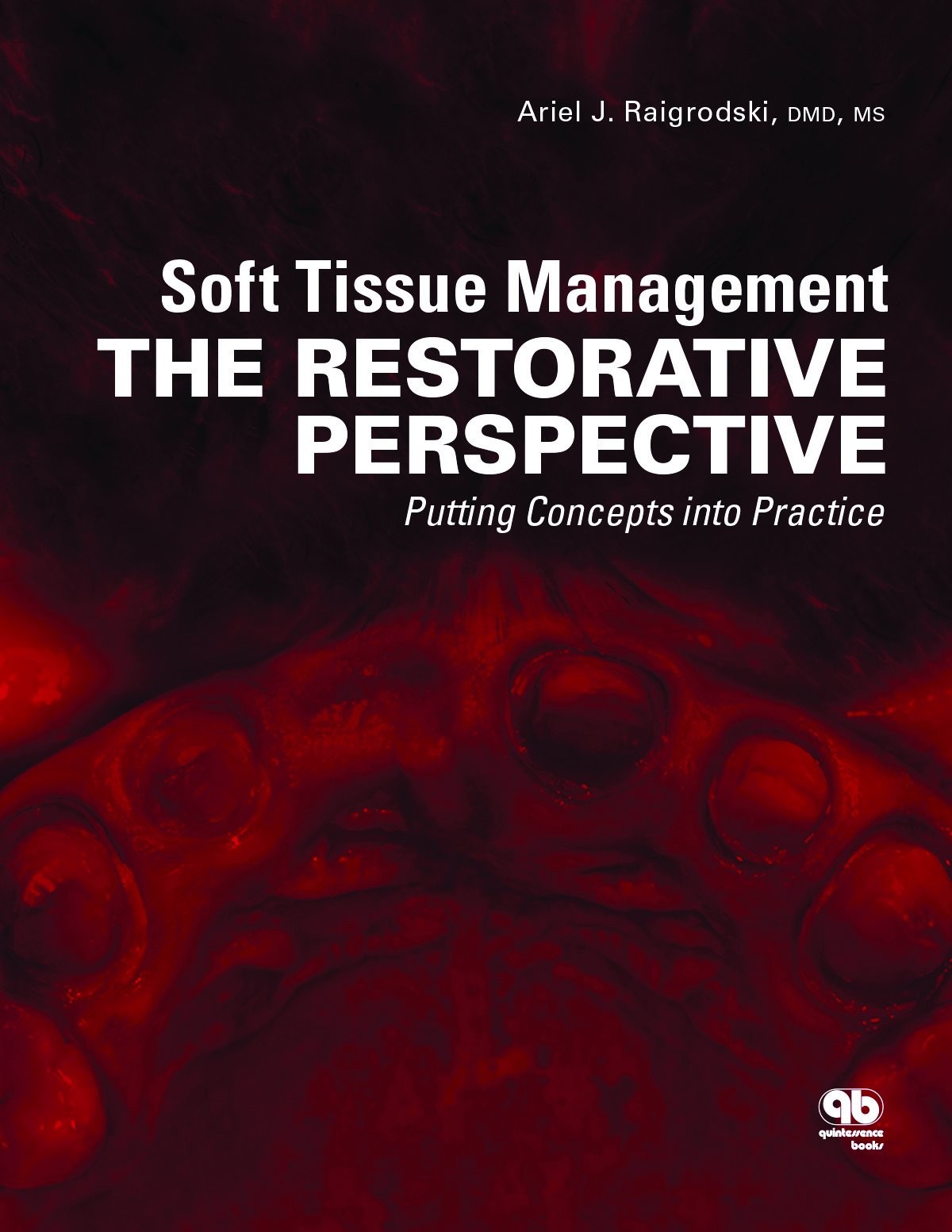 Soft Tissue Management: The Restorative Perspective: Putting Concepts into