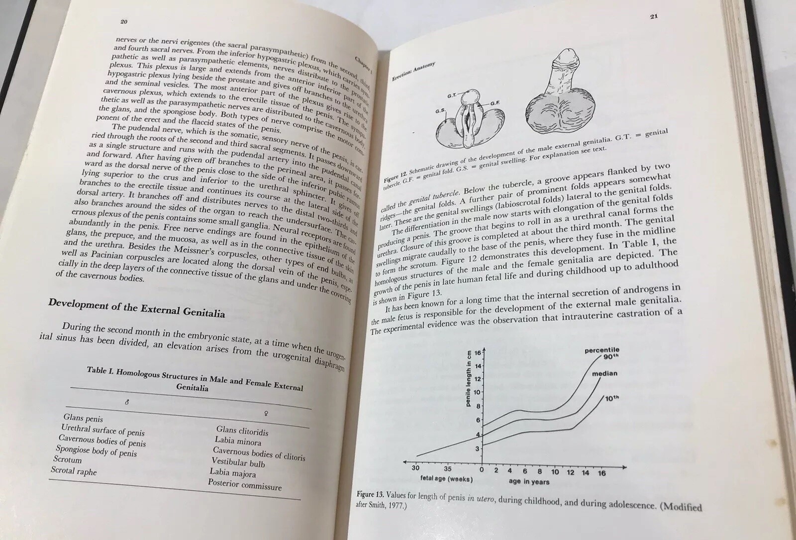 Impotence Physiological Psychological Surgical Diagnosis & Treatment by Wagner