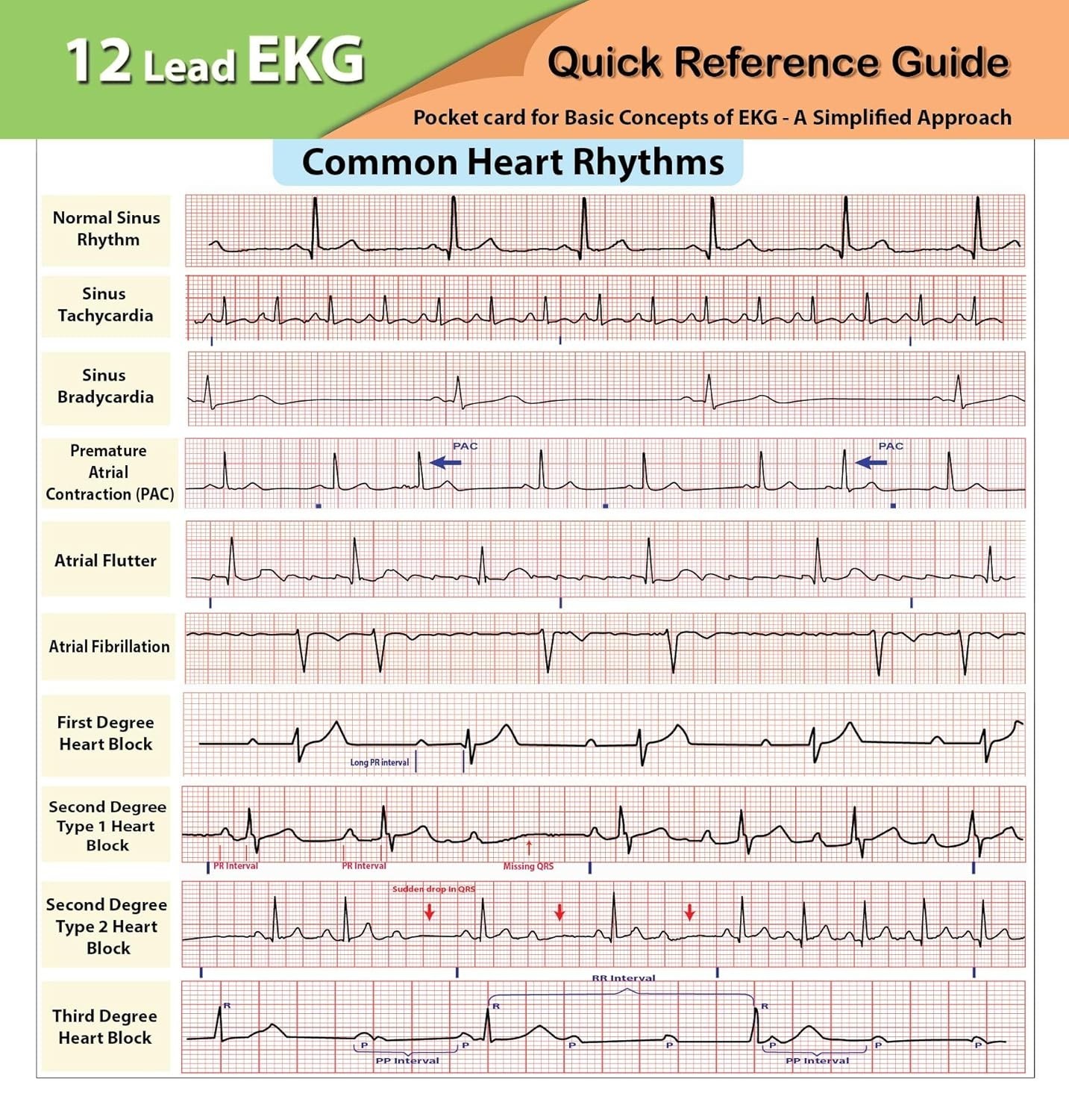 12 Lead EKG Pocket Card