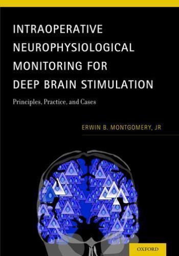 Intraoperative Neurophysiological Monitoring for Deep Brain Stimulation: Princip