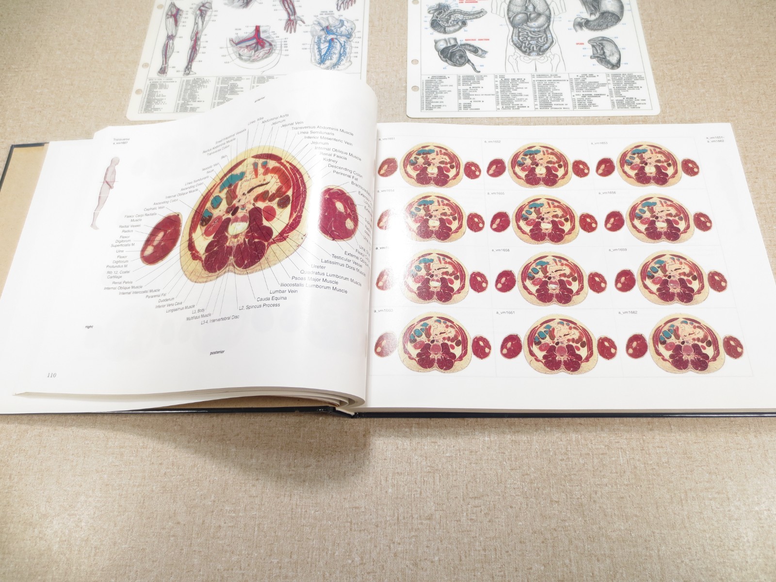 National Library of Medicine Atlas of The Visible Human Male Victor Spitzer