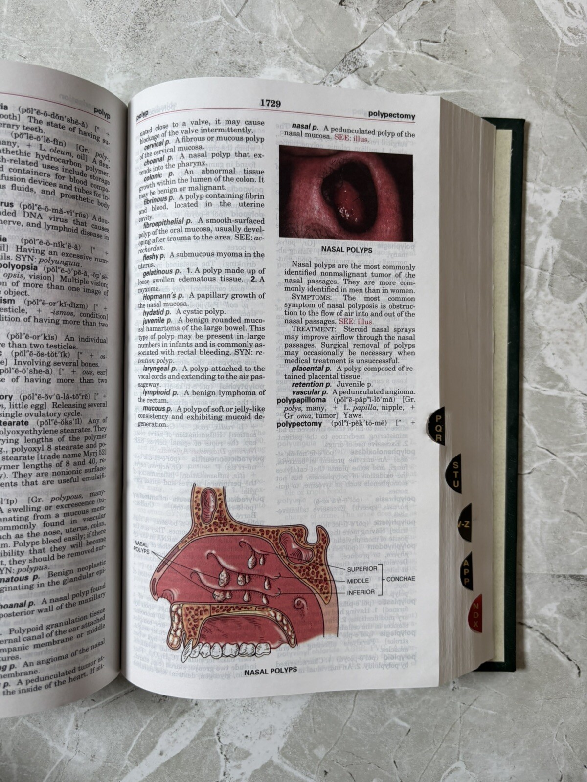 Taber’s Cyclopedic Medical Dictionary by Donald Venes (2005, Book, Other)
