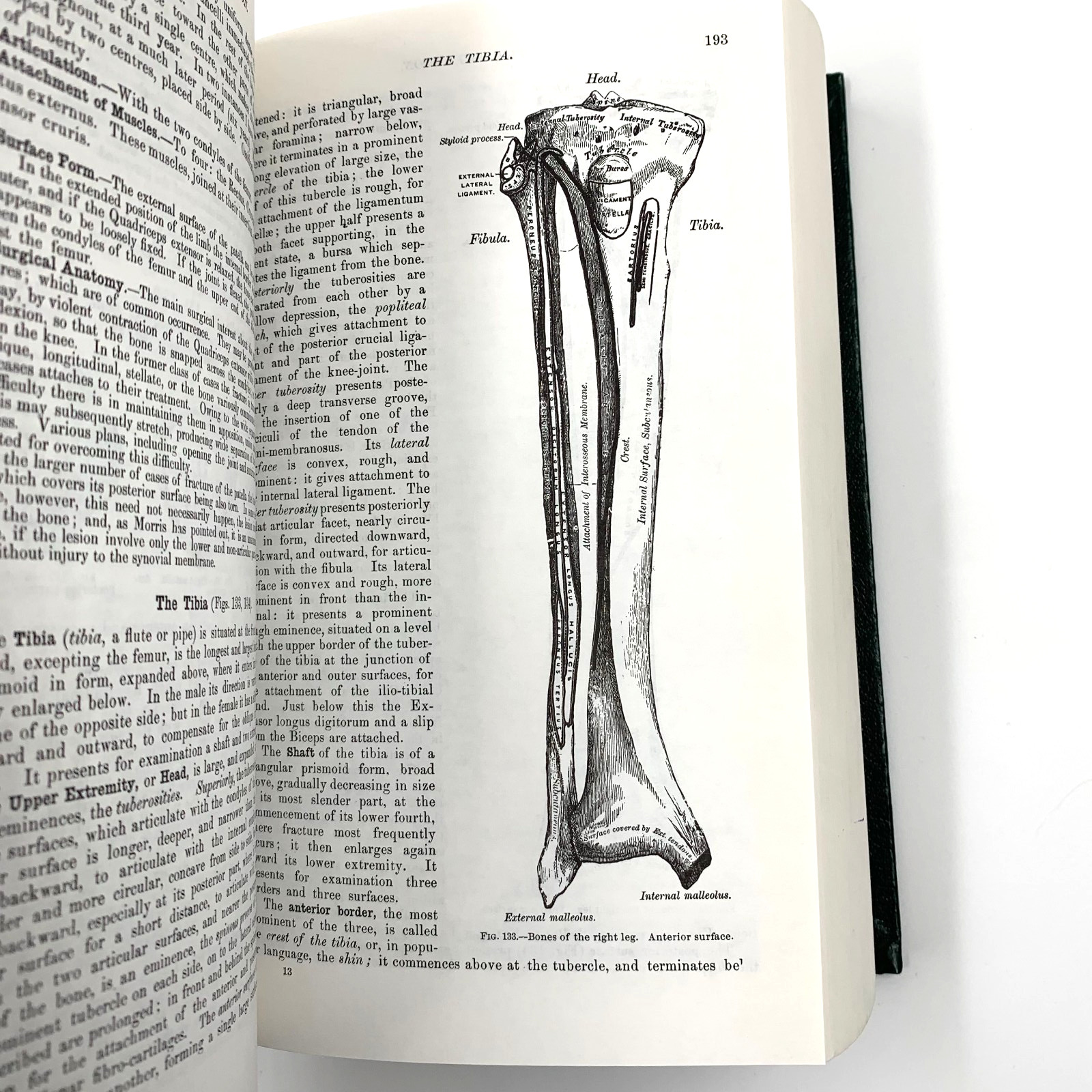 illustrated Running Press Edition of the American Classic Gray’s Anatomy HC 1974