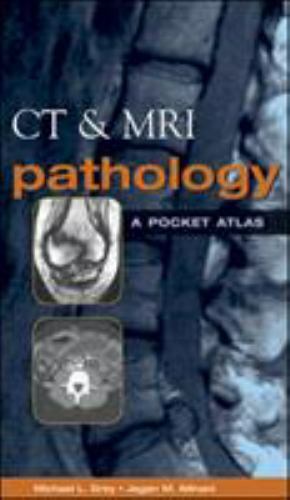 CT & MRI Pathology: A Pocket Atlas by Michael L. Grey; Jagan M. Ailinani
