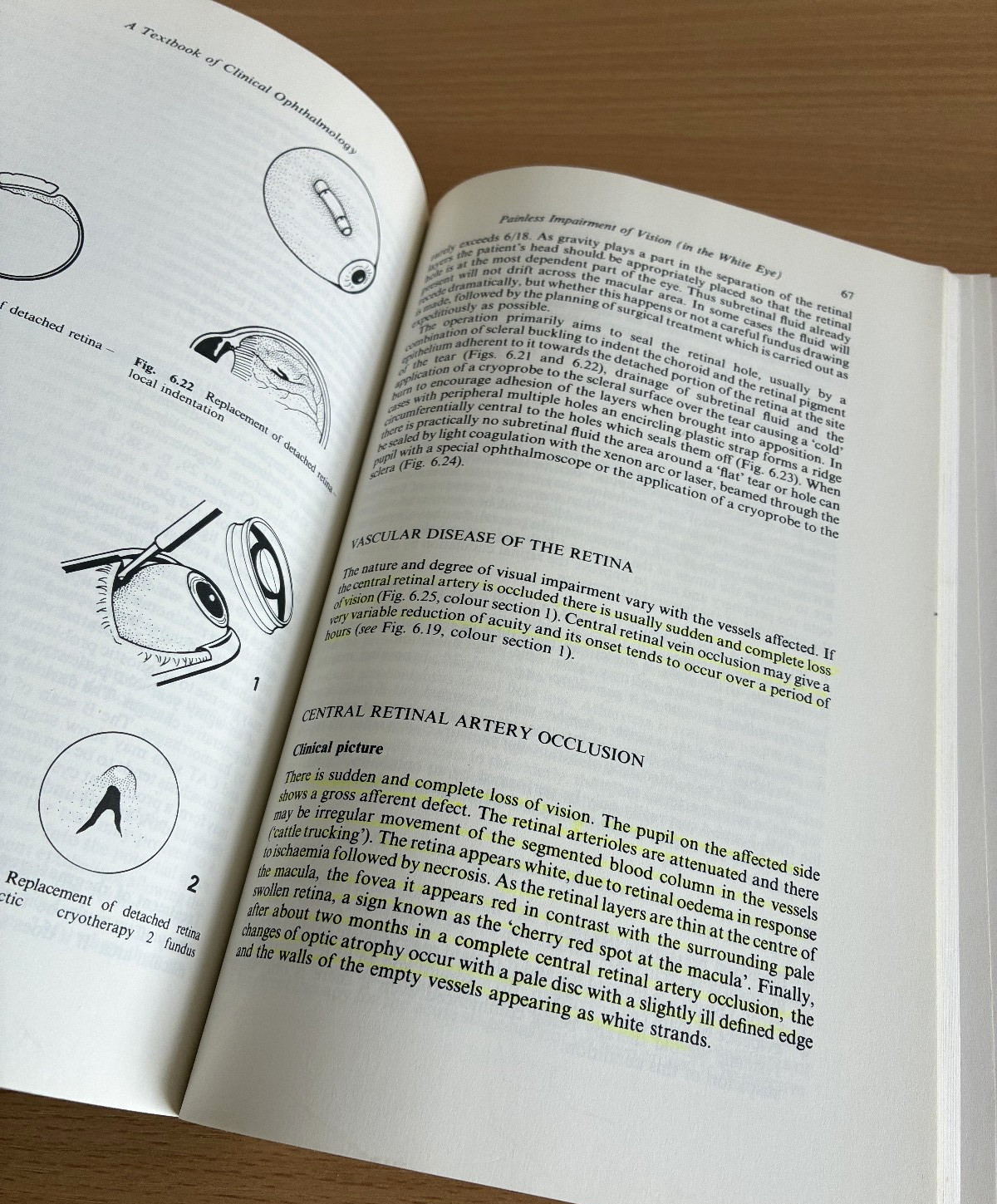 A Textbook Of Clinical Ophthalmology Crick Trimble 1986 Hodder & Stoughton 1st