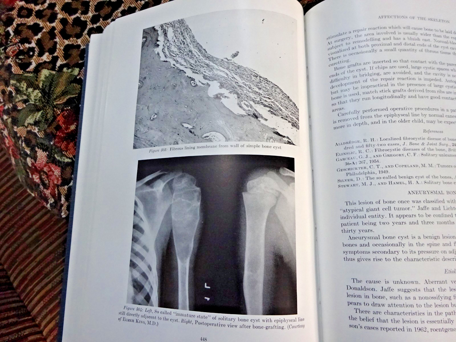 The Surgery of Infancy and Childhood 1963 Hard Cover with index 650 pages