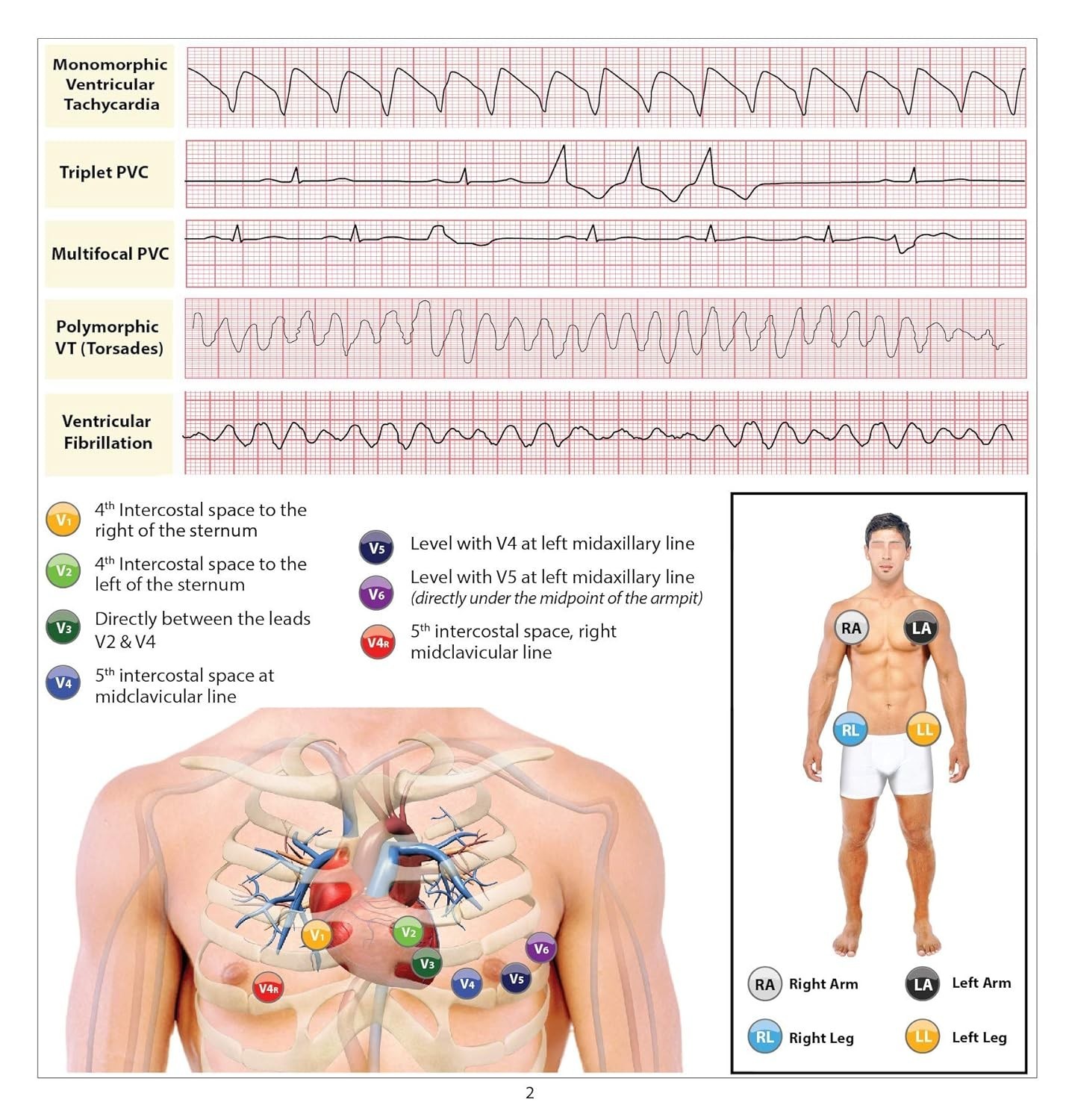 12 Lead EKG Pocket Card