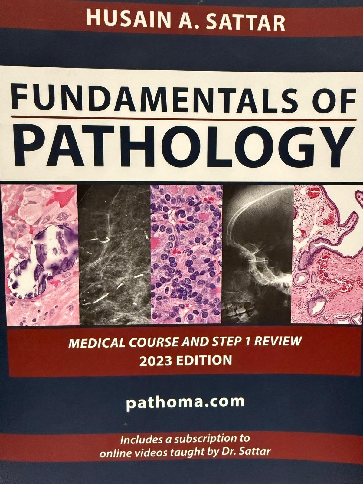 Fundamentals of Pathology by Hussain Asattar