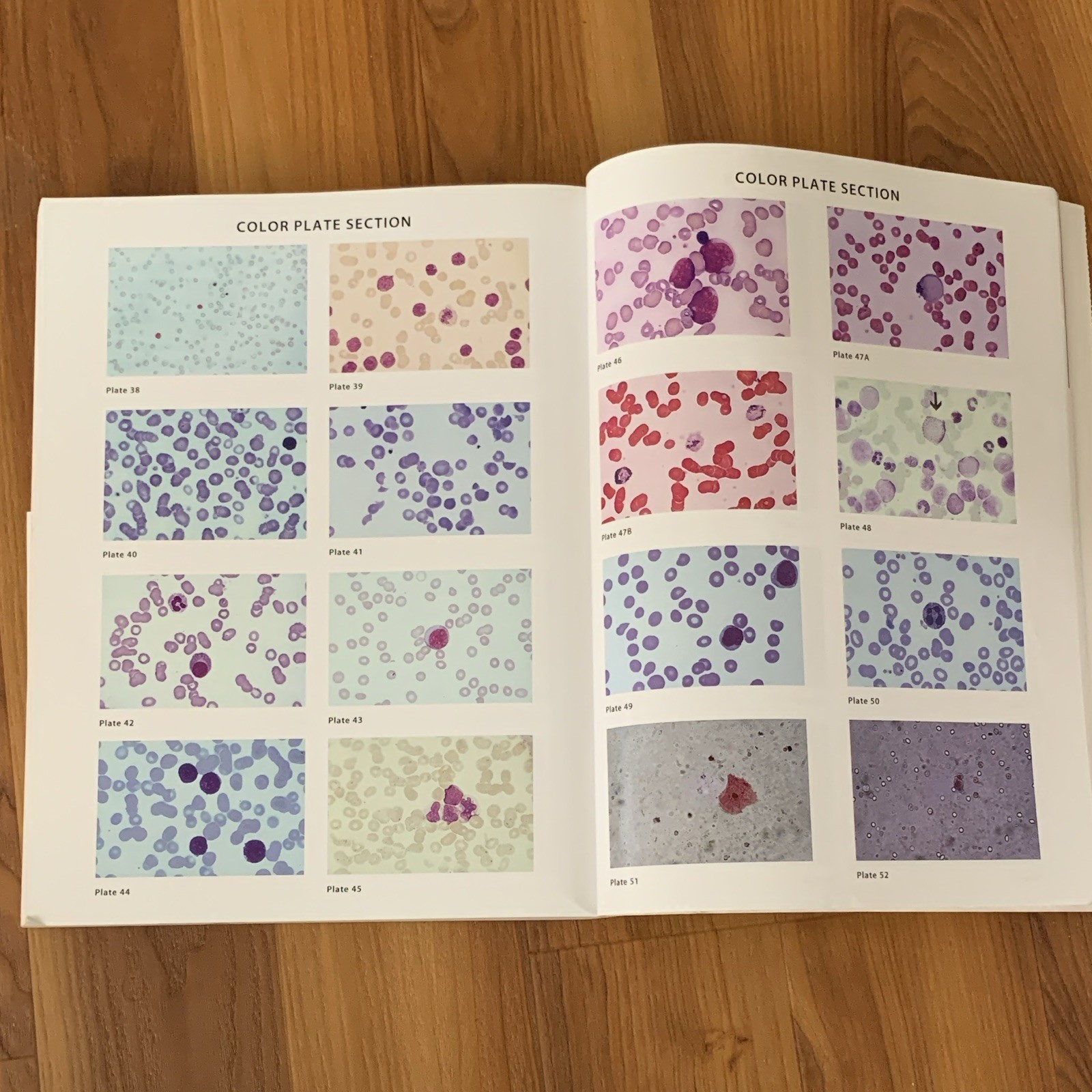 Medical Laboratory Science Review 5th Ed 2015 Paperback Harr F.A. Davis