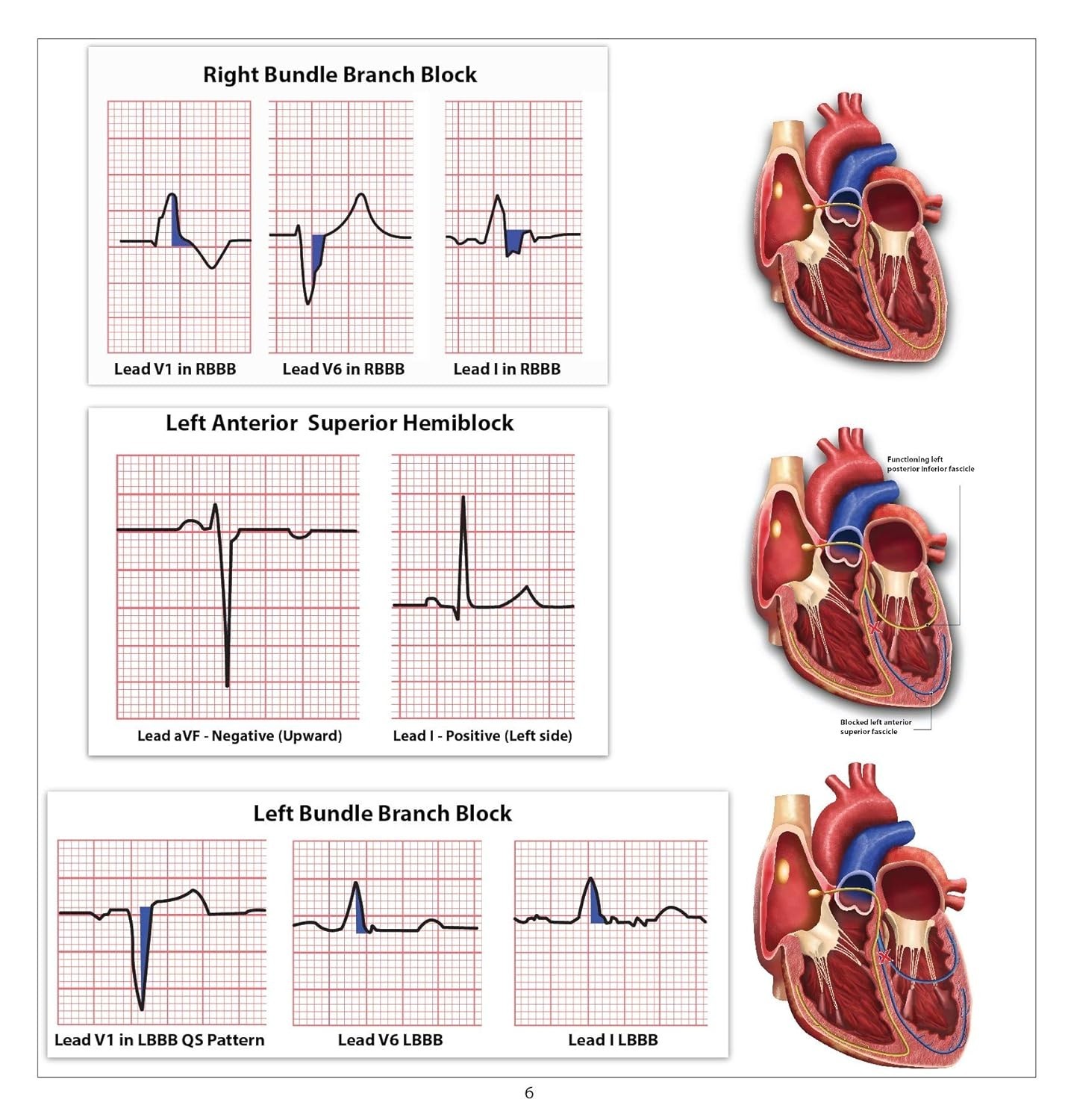 12 Lead EKG Pocket Card