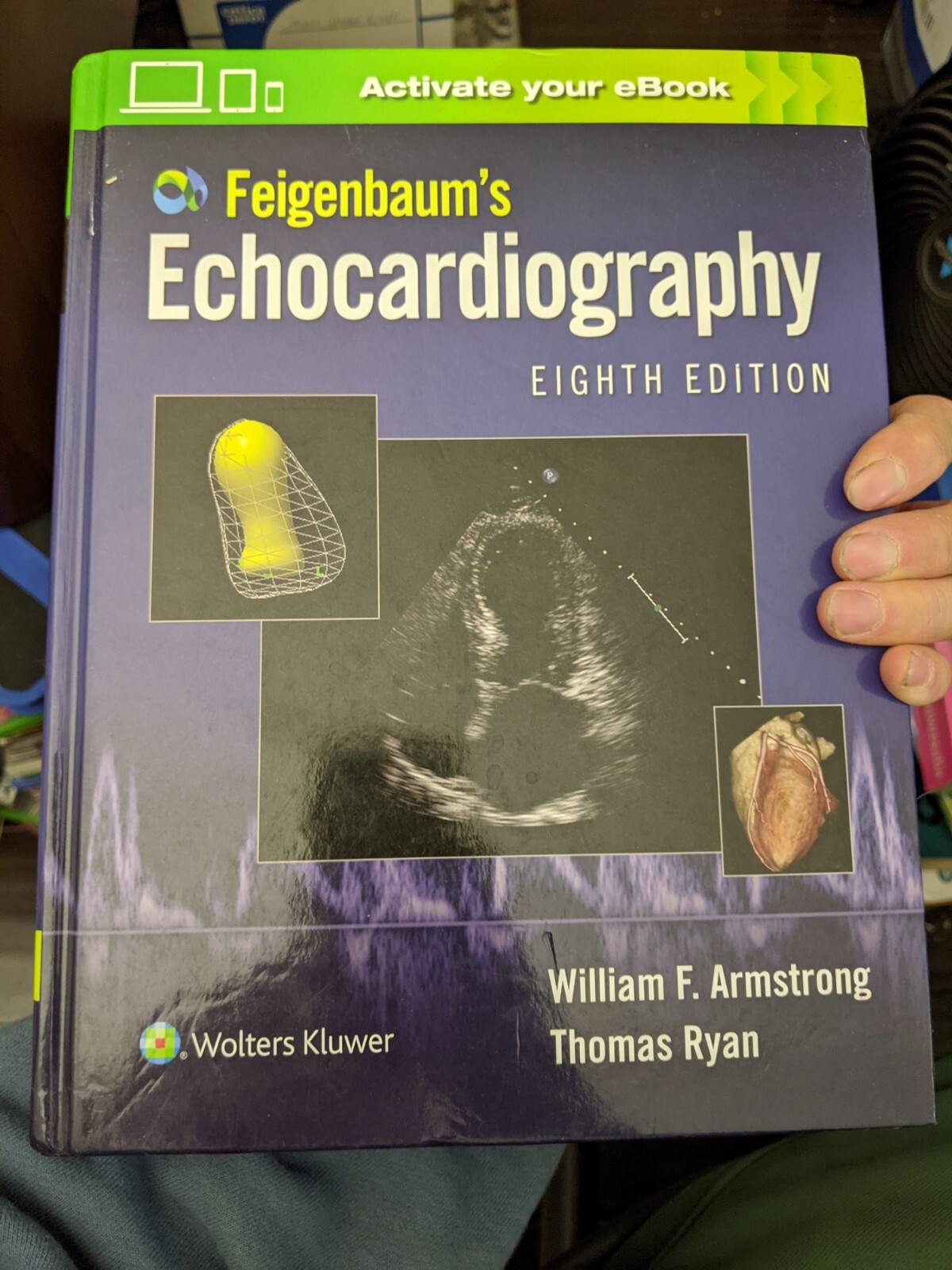 Feigenbaum’s Echocardiography – Thomas Ryan and William F. Armstrong (Hardcover)