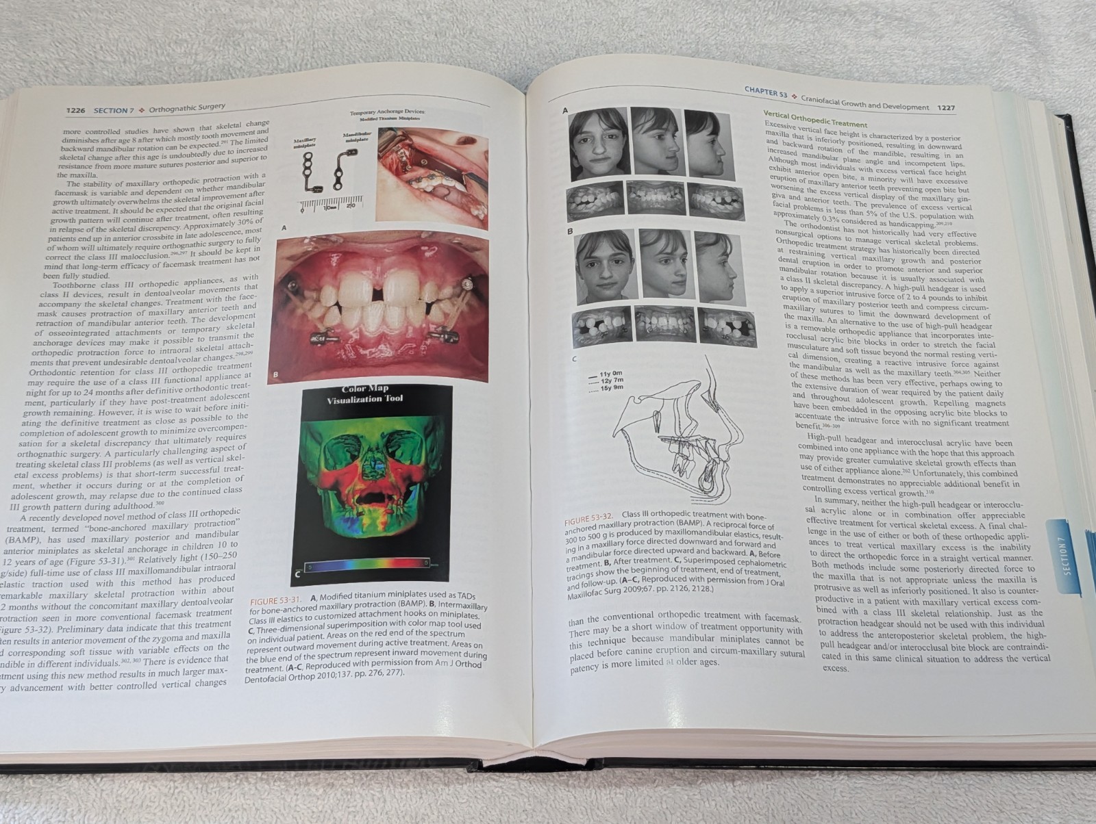 Volume 2 Only Peterson’s Principles of Oral and Maxillofacial Surgery Ghali USED