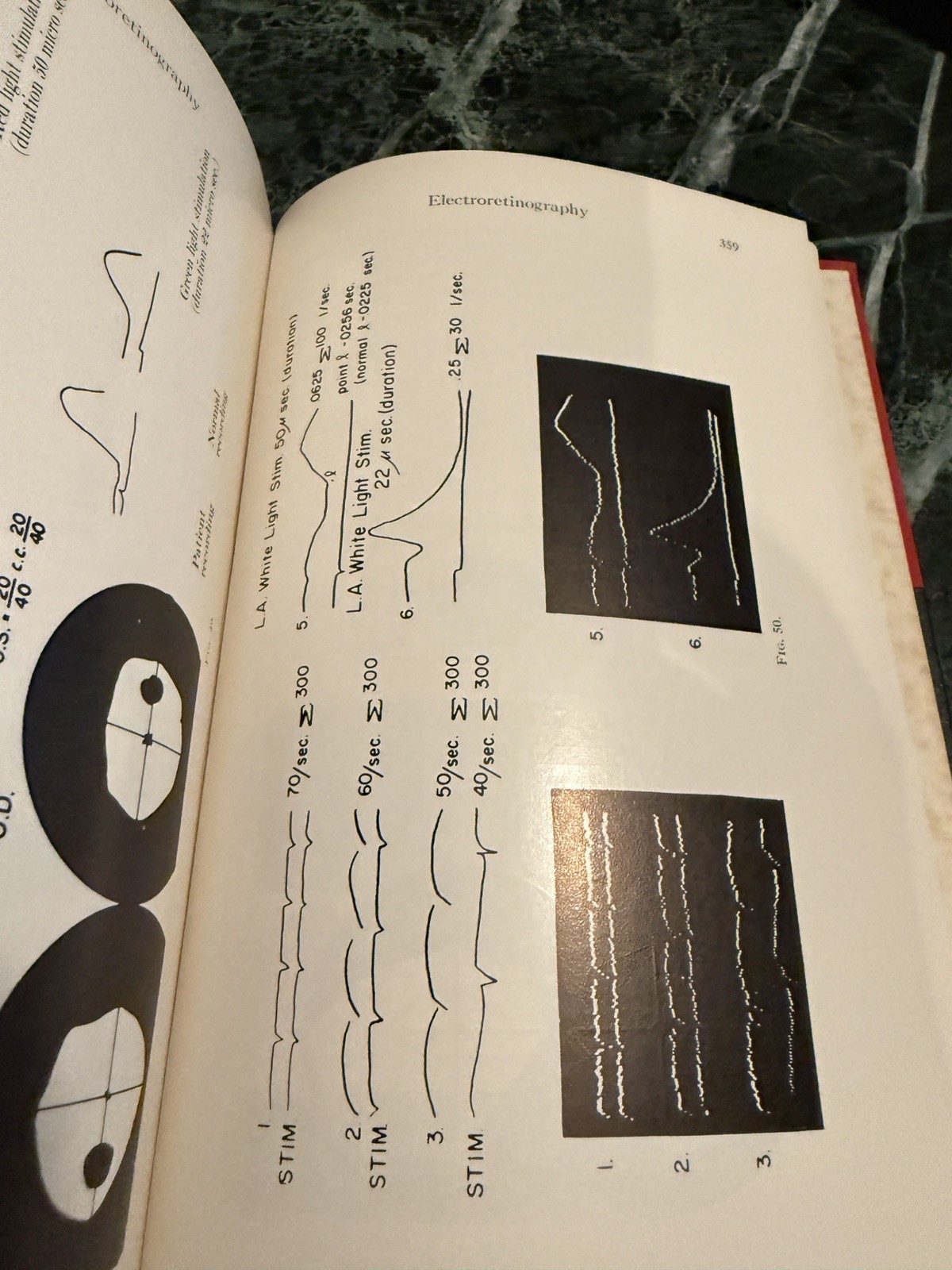 Pediatric Ophthalmology by L Byerly Holt Hardcover Book 1964 Excellent Cond