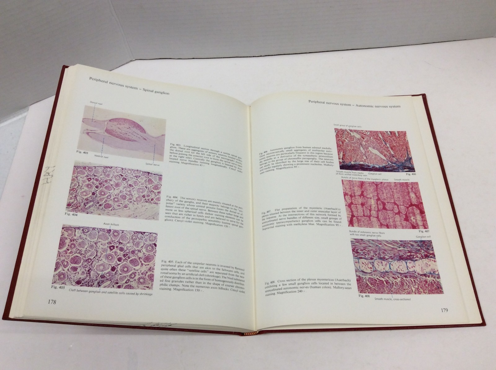 HISTOLOGY: A COLOR ATLAS Sobotta/Hammersen Illustrated HC 1976