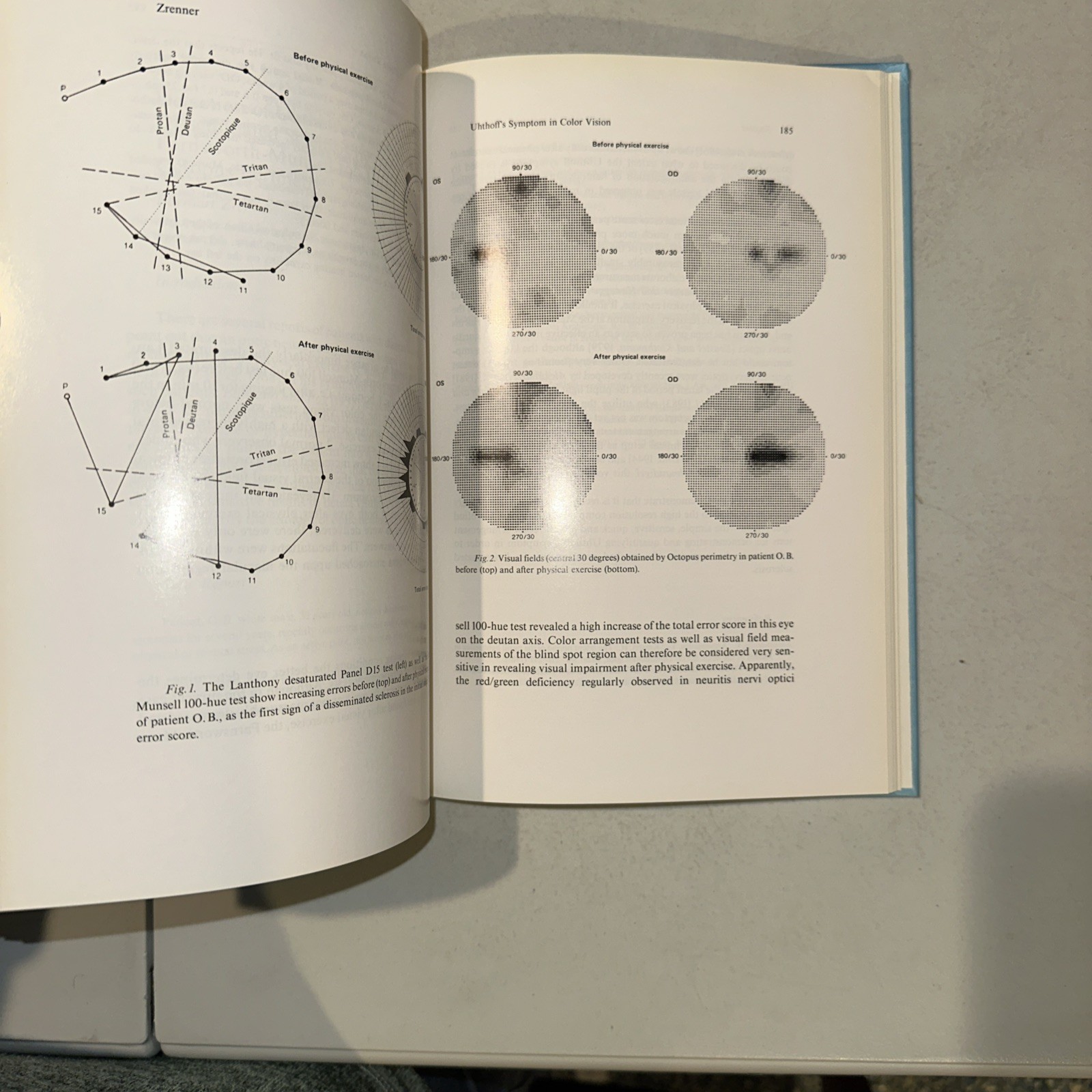 Developments in Ophthalmology Special Tests of Visual Function byZrenner (1984)