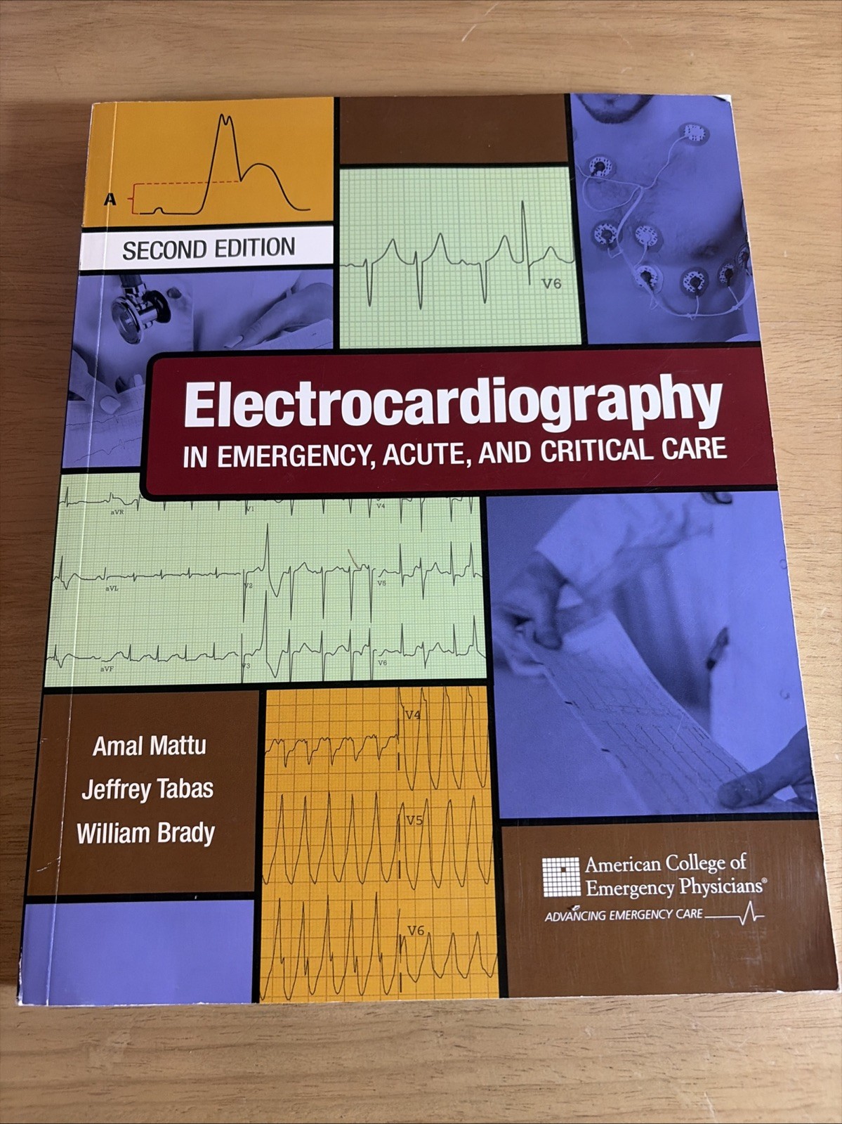 Electrocardiography Emergency Acute Critical Care 2nd Ed Mattu Tabas Brady